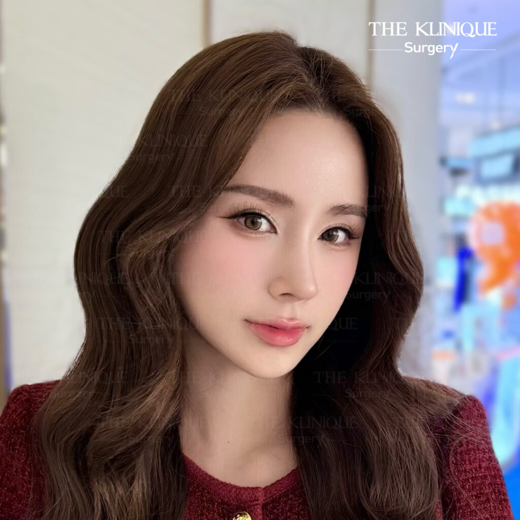 จมูก พส. จีน, หน้า พส จีน, พส จีน, V-Line, หน้า V-Line, Endoscopic, ศัลยกรรมคาง, เสริมคาง, เสริมคาง ปรับรูปหน้า, ตัดกราม,หุ่น พส.จีน