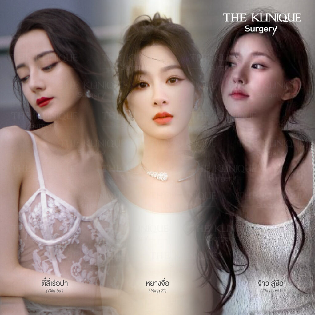 จมูก พส. จีน, หน้า พส จีน, พส จีน, V-Line, หน้า V-Line, Endoscopic, ศัลยกรรมคาง, เสริมคาง, เสริมคาง ปรับรูปหน้า, ตัดกราม,หุ่น พส.จีน