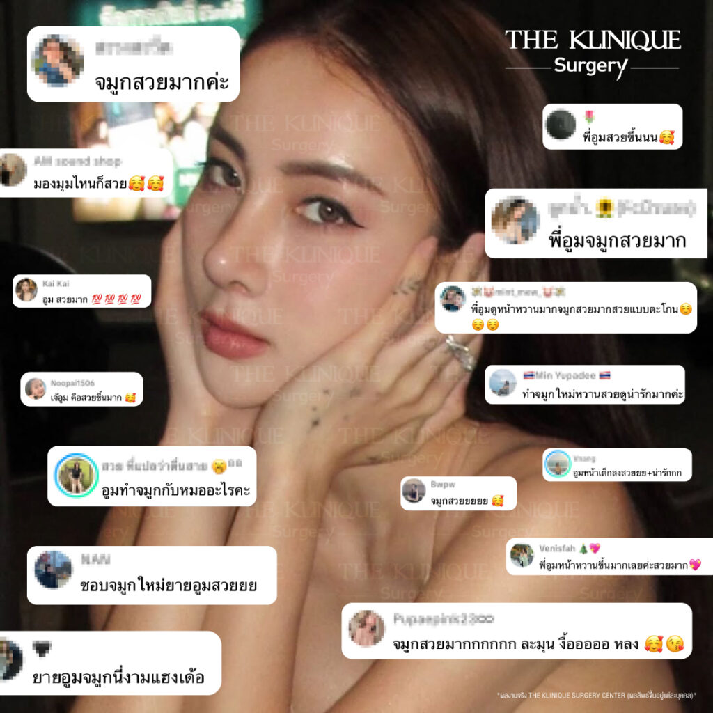 ศัลยกรรมจมูก, ศัลยกรรมจมูก รีวิว, เสริมจมูก, รีวิวเสริมจมูก, ทำจมูก, ทำจมูก รีวิว, ทำจมูก แบบ Open, ซิลิโคนจมูก, จมูก Open, เสริมจมูกโอเพ่น, เสริมจมูกOpen ที่ไหนดี, เสริมจมูกโอเพ่น ที่ไหนดี, เสริมจมูกโอเพ่น Open คือ, รีวิวเสริมจมูกโอเพ่น Open, ทรงจมูก, ทรงจมูกสวย, ทรงจมูกธรรมชาติ, ทรงจมูกสโลปปลายพุ่ง, ศัลยกรรมจมูกทีไ่หนดี, ศัลยกรรมจมูกมีกี่แบบ, เสริมจมูกที่ไหนดี, เสริมจมูกโอเพ่น, เสริมจมูกOpen, ทำจมูกรีวิว, ซิลิโคนจมูก,แก้จมูก, แก้จมูกที่ไหนดี, ทรงจมูกผู้ชาย, เสริมจมูกผู้ชาย, ศัลยฯจมูก, ถอดซิลิโคนจมูก, จมูก Semi Open