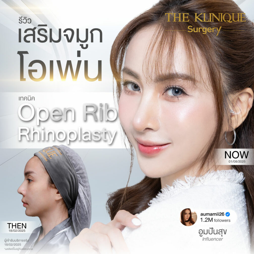 ศัลยกรรมจมูก, ศัลยกรรมจมูก รีวิว, เสริมจมูก, รีวิวเสริมจมูก, ทำจมูก, ทำจมูก รีวิว, ทำจมูก แบบ Open, ซิลิโคนจมูก, จมูก Open, เสริมจมูกโอเพ่น, เสริมจมูกOpen ที่ไหนดี, เสริมจมูกโอเพ่น ที่ไหนดี, เสริมจมูกโอเพ่น Open คือ, รีวิวเสริมจมูกโอเพ่น Open, ทรงจมูก, ทรงจมูกสวย, ทรงจมูกธรรมชาติ, ทรงจมูกสโลปปลายพุ่ง, ศัลยกรรมจมูกทีไ่หนดี, ศัลยกรรมจมูกมีกี่แบบ, เสริมจมูกที่ไหนดี, เสริมจมูกโอเพ่น, เสริมจมูกOpen, ทำจมูกรีวิว, ซิลิโคนจมูก,แก้จมูก, แก้จมูกที่ไหนดี, ทรงจมูกผู้ชาย, เสริมจมูกผู้ชาย, ศัลยฯจมูก, ถอดซิลิโคนจมูก, จมูก Semi Open