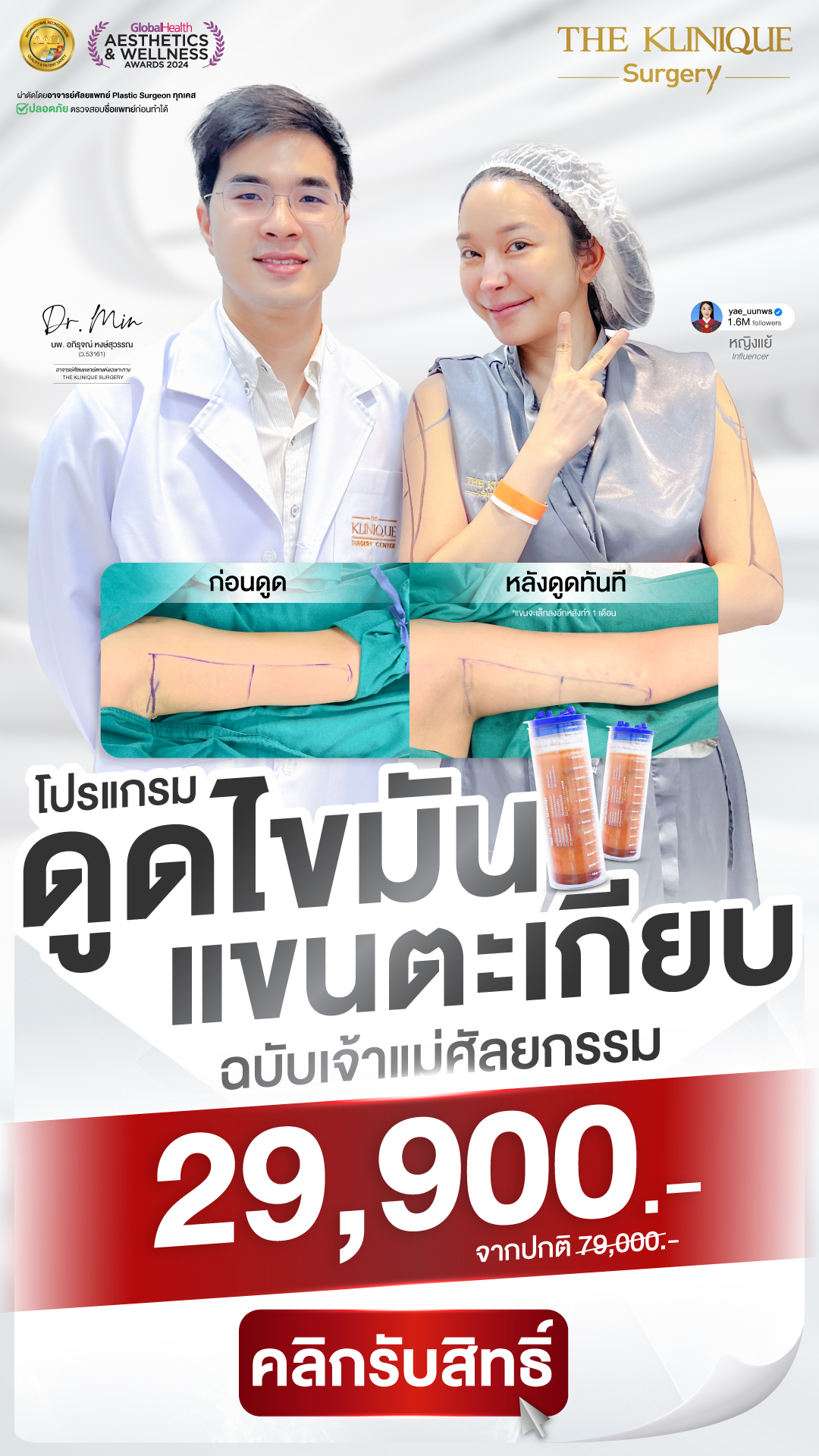 lipo” style=