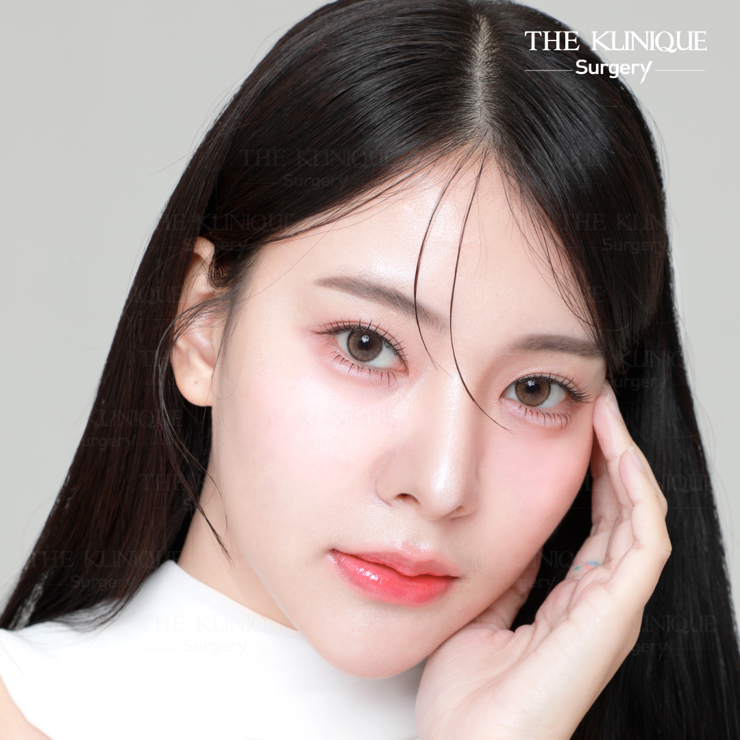 ศัลยกรรมตา, ศัลยกรรมตาสองชั้น, ศัลยกรรมตาสองชั้น ราคา, ศัลยกรรมตาที่ไหนดี, ศัลยกรรมตามีกี่แบบ, ตาสองชั้น, ตาสองชั้นหลบใน, คลินิกทำตา, ตาสองชั้นที่ไหนดี, ตาสองชั้นแบบกรีดสั้น กรีดยาว, กล้ามเนื้อตาอ่อนแรง, แก้ตา, แก้ตาสองชั้น, แก้หนังตาตก, แก้ชั้นตาใหญ่, แก้ตาไม่เท่ากัน, หนังตาตก, แก้หนังตาตก, ตาสองชั้นรีวิว, ตา 2 ชั้น, รีวิว ตาสองชั้น, ทำตาสองชั้น, Sub Brow Lift, Foxy eyes, ยกหางตา, หางตาตก, หมอศัลยกรรมตา