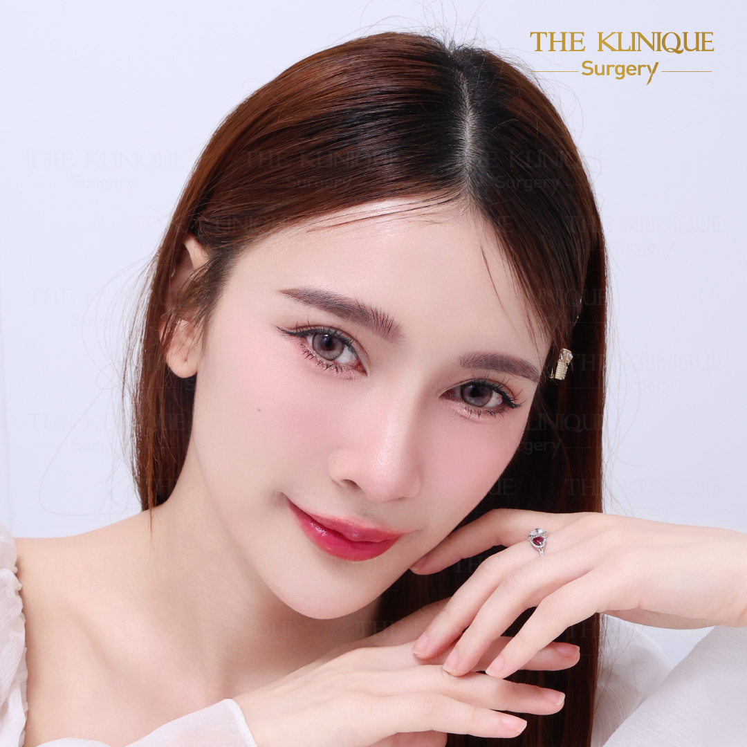 ศัลยกรรมตา, ศัลยกรรมตาสองชั้น, ศัลยกรรมตาสองชั้น ราคา, ศัลยกรรมตาที่ไหนดี, ศัลยกรรมตามีกี่แบบ, ตาสองชั้น, ตาสองชั้นหลบใน, คลินิกทำตา, ตาสองชั้นที่ไหนดี, ตาสองชั้นแบบกรีดสั้น กรีดยาว, กล้ามเนื้อตาอ่อนแรง, แก้ตา, แก้ตาสองชั้น, แก้หนังตาตก, แก้ชั้นตาใหญ่, แก้ตาไม่เท่ากัน, หนังตาตก, แก้หนังตาตก, ตาสองชั้นรีวิว, ตา 2 ชั้น, รีวิว ตาสองชั้น, ทำตาสองชั้น, Sub Brow Lift, Foxy eyes, ยกหางตา, หางตาตก, หมอศัลยกรรมตา