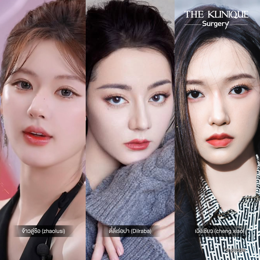 ศัลยกรรมตา, ศัลยกรรมตาสองชั้น, ศัลยกรรมตาสองชั้น ราคา, ศัลยกรรมตาที่ไหนดี, ศัลยกรรมตามีกี่แบบ, ตาสองชั้น, ตาสองชั้นหลบใน, คลินิกทำตา, ตาสองชั้นที่ไหนดี, ตาสองชั้นแบบกรีดสั้น กรีดยาว, กล้ามเนื้อตาอ่อนแรง, แก้ตา, แก้ตาสองชั้น, แก้หนังตาตก, แก้ชั้นตาใหญ่, แก้ตาไม่เท่ากัน, หนังตาตก, แก้หนังตาตก, ตาสองชั้นรีวิว, ตา 2 ชั้น, รีวิว ตาสองชั้น, ทำตาสองชั้น, Sub Brow Lift, Foxy eyes, ยกหางตา, หางตาตก, หมอศัลยกรรมตา 