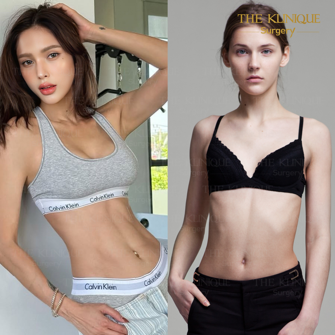 Liposuction, Sculpting,Xshape,Lipo, ศัลยกรรมดูดไขมัน, ดูดไขมัน,คลินิกดูดไขมัน,ดูดไขมันเฉพาะส่วน,ดูดไขมันเหนียง,ดูดไขมันหน้าท้อง,ดูดไขมันรีวิว, รีวิวดูดไขมัน, รีวิวดูดไขมันหน้าท้อง,ดูดไขมันต้นแขน, ดูดไขมันต้นขา,ดูดไขมันน่อง, ลดความอ้วน, ดูดไขมันที่ไหนดี, ดูดไขมันราคา, ดูดไขมันทั้งตัว