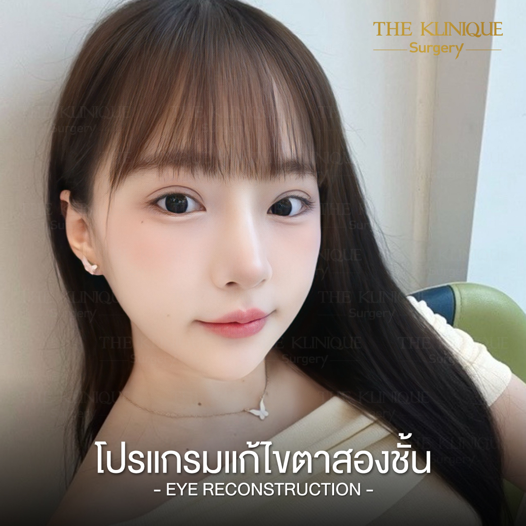 ศัลยกรรมตา, ศัลยกรรมตาสองชั้น, ศัลยกรรมตาสองชั้น ราคา, ศัลยกรรมตาที่ไหนดี, ศัลยกรรมตามีกี่แบบ, ตาสองชั้น, ตาสองชั้นหลบใน, คลินิกทำตา, ตาสองชั้นที่ไหนดี, ตาสองชั้นแบบกรีดสั้น กรีดยาว, กล้ามเนื้อตาอ่อนแรง, แก้ตา, แก้ตาสองชั้น, แก้หนังตาตก, แก้ชั้นตาใหญ่, แก้ตาไม่เท่ากัน, หนังตาตก, แก้หนังตาตก, ตาสองชั้นรีวิว, ตา 2 ชั้น, รีวิว ตาสองชั้น, ทำตาสองชั้น, Sub Brow Lift, Foxy eyes, ยกหางตา, หางตาตก, หมอศัลยกรรมตา