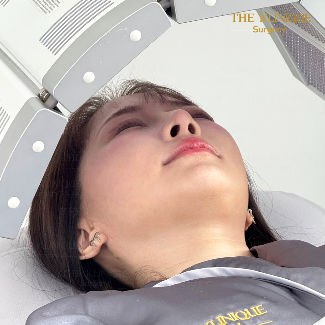 ศัลยกรรมตา, ศัลยกรรมตาสองชั้น, ศัลยกรรมตาสองชั้น ราคา, ศัลยกรรมตาที่ไหนดี, ศัลยกรรมตามีกี่แบบ, ตาสองชั้น, ตาสองชั้นหลบใน, คลินิกทำตา, ตาสองชั้นที่ไหนดี, ตาสองชั้นแบบกรีดสั้น กรีดยาว, กล้ามเนื้อตาอ่อนแรง, แก้ตา, แก้ตาสองชั้น, แก้หนังตาตก, แก้ชั้นตาใหญ่, แก้ตาไม่เท่ากัน, หนังตาตก, แก้หนังตาตก, ตาสองชั้นรีวิว, ตา 2 ชั้น, รีวิว ตาสองชั้น, ทำตาสองชั้น, Sub Brow Lift, Foxy eyes, ยกหางตา, หางตาตก, หมอศัลยกรรมตา