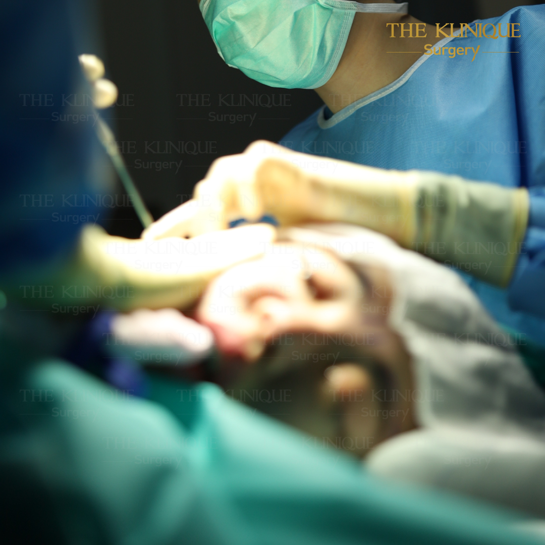 ศัลยกรรมดึงหน้า, ดึงหน้า, ดึงหน้าผาก, ดึงหน้าผาก ยกคิ้ว, Face Lock, Face Lift, ดึงหน้า ดึงคอ, ดึงหน้าย้อนวัย, ดึงหน้าดารา, Necklift, Face Lift คือ,Endotine หน้าผาก,ดึงหน้าผาก ยกคิ้ว, ศัลยกรรมดึงหน้าผาก, ดึงหน้าย้อนวัย, ศัลยกรรมยกคิ้ว, รีวิวศัลยกรรมยกคิ้ว, Endotine, Endotine รีวิว, ยกคิ้วส่องกล้อง, ผ่าตัดส่องกล้อง, ผ่าตัดดึงหน้า, Endotine รีวิว, ยกคิ้ว รีวิว, ยกคิ้วส่องกล้อง, ยกคิ้วส่องกล้อง รีวิว, ยกคิ้วที่ไหนดี