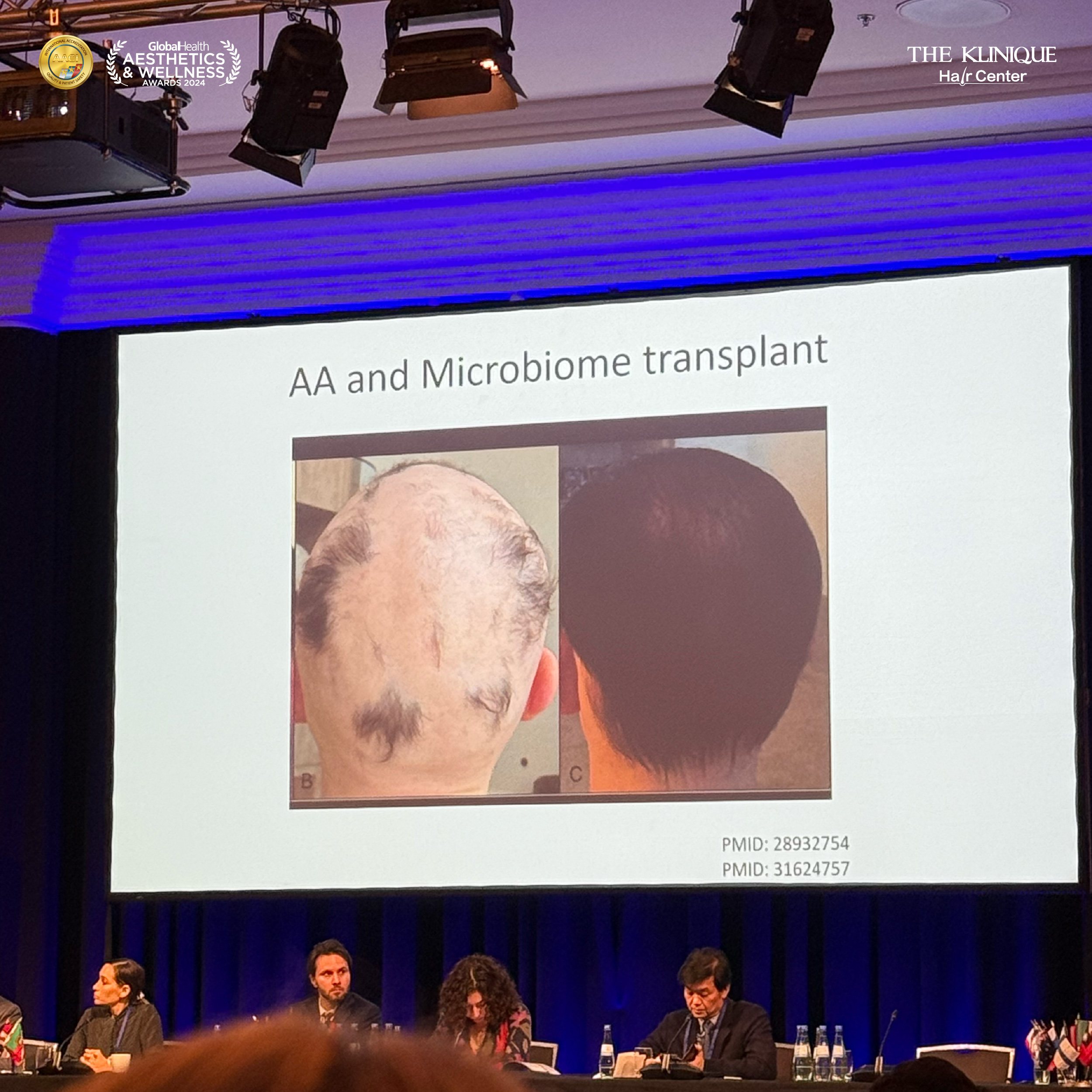 ศัลยกรรมปลูกผม, ปลูกผมที่ไหนดี, ปลูกผมราคา, ปลูกผมถาวร, ปลูกผม ผมบาง, ปลูกผม ถาวร ราคา,ผมร่วง, ผมร่วงเกิดจากอะไร, ผมร่วง ปลูกผม, ปัญหาผมร่วง, ลดผมร่วง, แก้ผมร่วง, แก้ผมขาดร่วง, คลินกปลูกผม,ปลูกผมบาง, รากผมฝ่อ,ผมบาง, ปลูกผม, วิธีแก้ผมบาง, ศูนย์ดูแลเส้นผม, hair center, หัวเถิก, หัวล้าน, ศีรษะล้าน, ปลูกผมเทคนิคไหนดี, ปลูกผมมีกี่แบบ, ปลูกผม FUE, ปลูกผม DHI, รีวิว ปลูกผม , เซลล์กราผม, ยาปลูกผม, กราฟผม, กราฟปลูกผม, กระตุ้นรากผม, กระตุ้นเซลล์ผม, รากผมอ่อนแอ, ปัญหาผม,รักษาเส้นผม, รักษาผมร่วง, รักษารากผม, รักษาผมบาง