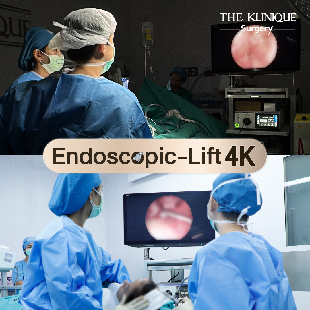 ศัลยกรรมดึงหน้า, ดึงหน้า, ดึงหน้าผาก, ดึงหน้าผาก ยกคิ้ว, Face Lock, Face Lift, ดึงหน้า ดึงคอ, ดึงหน้าย้อนวัย, ดึงหน้าดารา, Necklift, Face Lift คือ,Endotine หน้าผาก,ดึงหน้าผาก ยกคิ้ว, ศัลยกรรมดึงหน้าผาก, ดึงหน้าย้อนวัย, ศัลยกรรมยกคิ้ว, รีวิวศัลยกรรมยกคิ้ว, Endotine, Endotine รีวิว, ยกคิ้วส่องกล้อง, ผ่าตัดส่องกล้อง, ผ่าตัดดึงหน้า, Endotine รีวิว, ยกคิ้ว รีวิว, ยกคิ้วส่องกล้อง, ยกคิ้วส่องกล้อง รีวิว, ยกคิ้วที่ไหนดี