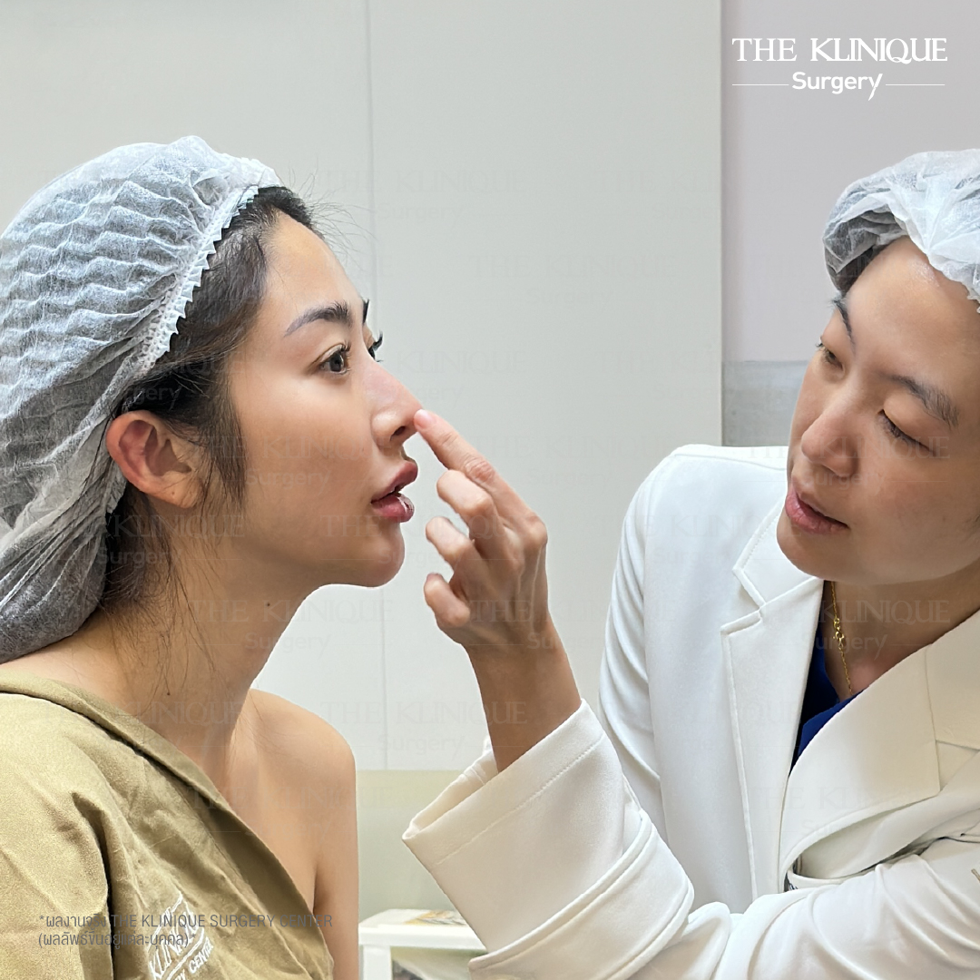 ศัลยกรรมจมูก, ศัลยกรรมจมูก รีวิว, เสริมจมูก, รีวิวเสริมจมูก, ทำจมูก, ทำจมูก รีวิว, ทำจมูกแบบ Open, ซิลิโคนจมูก, จมูก Open, เสริมจมูกโอเพ่น, เสริมจมูกOpen ที่ไหนดี,  เสริมจมูกโอเพ่น  ที่ไหนดี,  เสริมจมูกโอเพ่น Open คือ, รีวิวเสริมจมูกโอเพ่น Open, ทรงจมูก, ทรงจมูกสวย, ทรงจมูกธรรมชาติ, ทรงจมูกสโลปปลายพุ่ง,ทรงจมูก,จมูก พส, จีน พส จีน