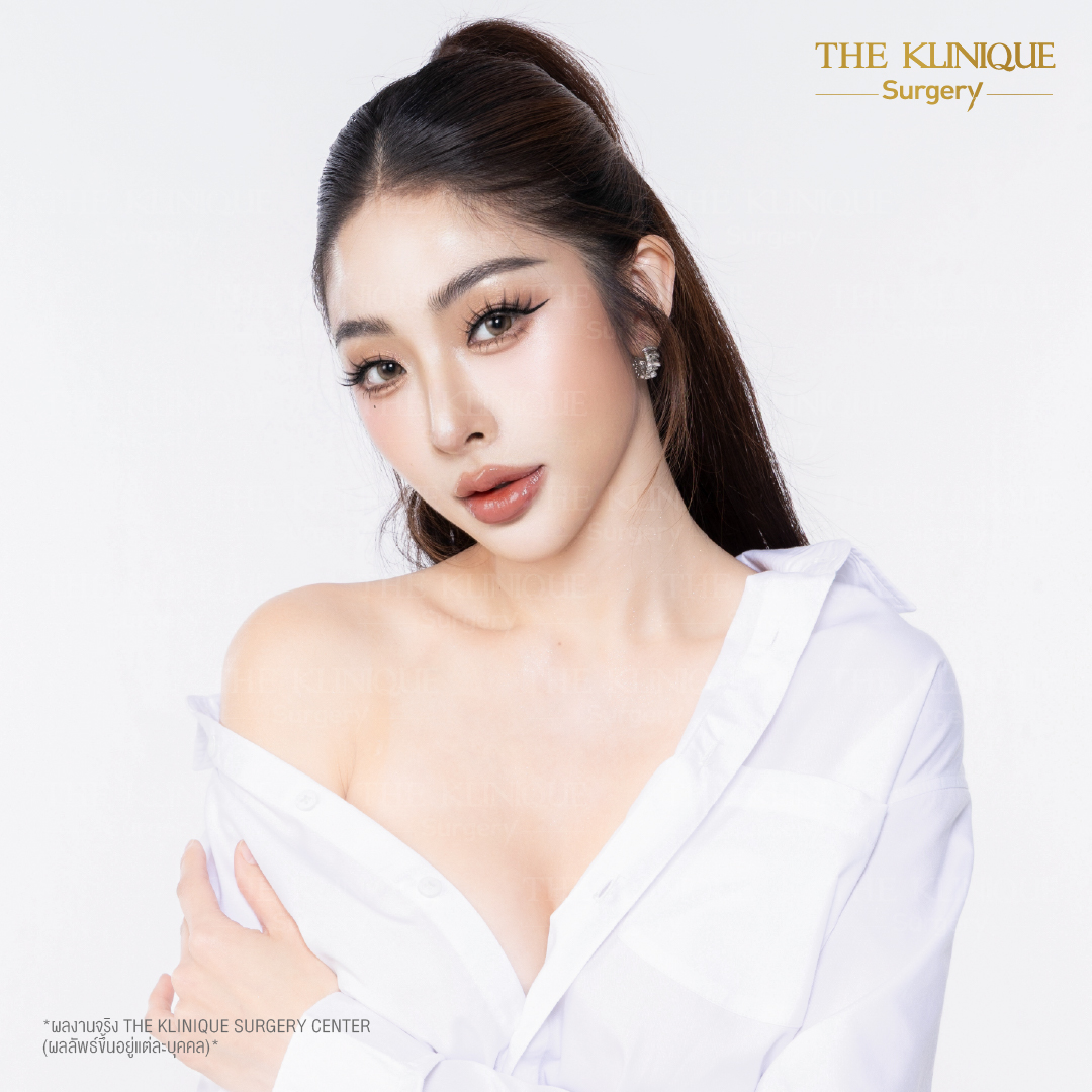 ศัลยกรรมจมูก, ศัลยกรรมจมูก รีวิว, เสริมจมูก, รีวิวเสริมจมูก, ทำจมูก, ทำจมูก รีวิว, ทำจมูกแบบ Open, ซิลิโคนจมูก, จมูก Open, เสริมจมูกโอเพ่น, เสริมจมูกOpen ที่ไหนดี, เสริมจมูกโอเพ่น ที่ไหนดี, เสริมจมูกโอเพ่น Open คือ, รีวิวเสริมจมูกโอเพ่น Open, ทรงจมูก, ทรงจมูกสวย, ทรงจมูกธรรมชาติ, ทรงจมูกสโลปปลายพุ่ง,ทรงจมูก,จมูก พส, จีน พส จีน