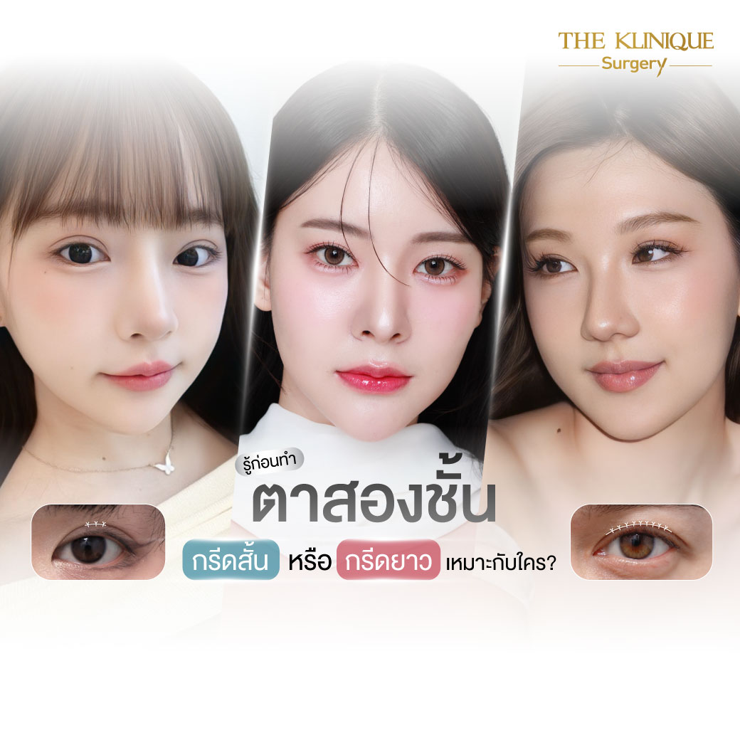 ศัลยกรรมตา, ศัลยกรรมตาสองชั้น, ศัลยกรรมตาสองชั้น ราคา, ศัลยกรรมตาที่ไหนดี, ศัลยกรรมตามีกี่แบบ, ตาสองชั้น, ตาสองชั้นหลบใน, คลินิกทำตา, ตาสองชั้นที่ไหนดี, ตาสองชั้นแบบกรีดสั้น กรีดยาว, กล้ามเนื้อตาอ่อนแรง, แก้ตา, แก้ตาสองชั้น, แก้หนังตาตก, แก้ชั้นตาใหญ่, แก้ตาไม่เท่ากัน, หนังตาตก, แก้หนังตาตก, ตาสองชั้นรีวิว, ตา 2 ชั้น, รีวิว ตาสองชั้น, ทำตาสองชั้น, Sub Brow Lift, Foxy eyes, ยกหางตา, หางตาตก, หมอศัลยกรรมตา