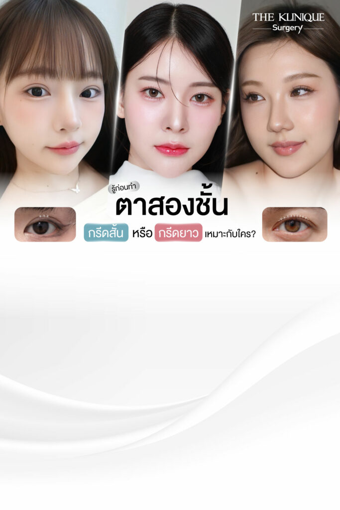 ศัลยกรรมตา, ศัลยกรรมตาสองชั้น, ศัลยกรรมตาสองชั้น ราคา, ศัลยกรรมตาที่ไหนดี, ศัลยกรรมตามีกี่แบบ, ตาสองชั้น, ตาสองชั้นหลบใน, คลินิกทำตา, ตาสองชั้นที่ไหนดี, ตาสองชั้นแบบกรีดสั้น กรีดยาว, กล้ามเนื้อตาอ่อนแรง, แก้ตา, แก้ตาสองชั้น, แก้หนังตาตก, แก้ชั้นตาใหญ่, แก้ตาไม่เท่ากัน, หนังตาตก, แก้หนังตาตก, ตาสองชั้นรีวิว, ตา 2 ชั้น, รีวิว ตาสองชั้น, ทำตาสองชั้น, Sub Brow Lift, Foxy eyes, ยกหางตา, หางตาตก, หมอศัลยกรรมตา