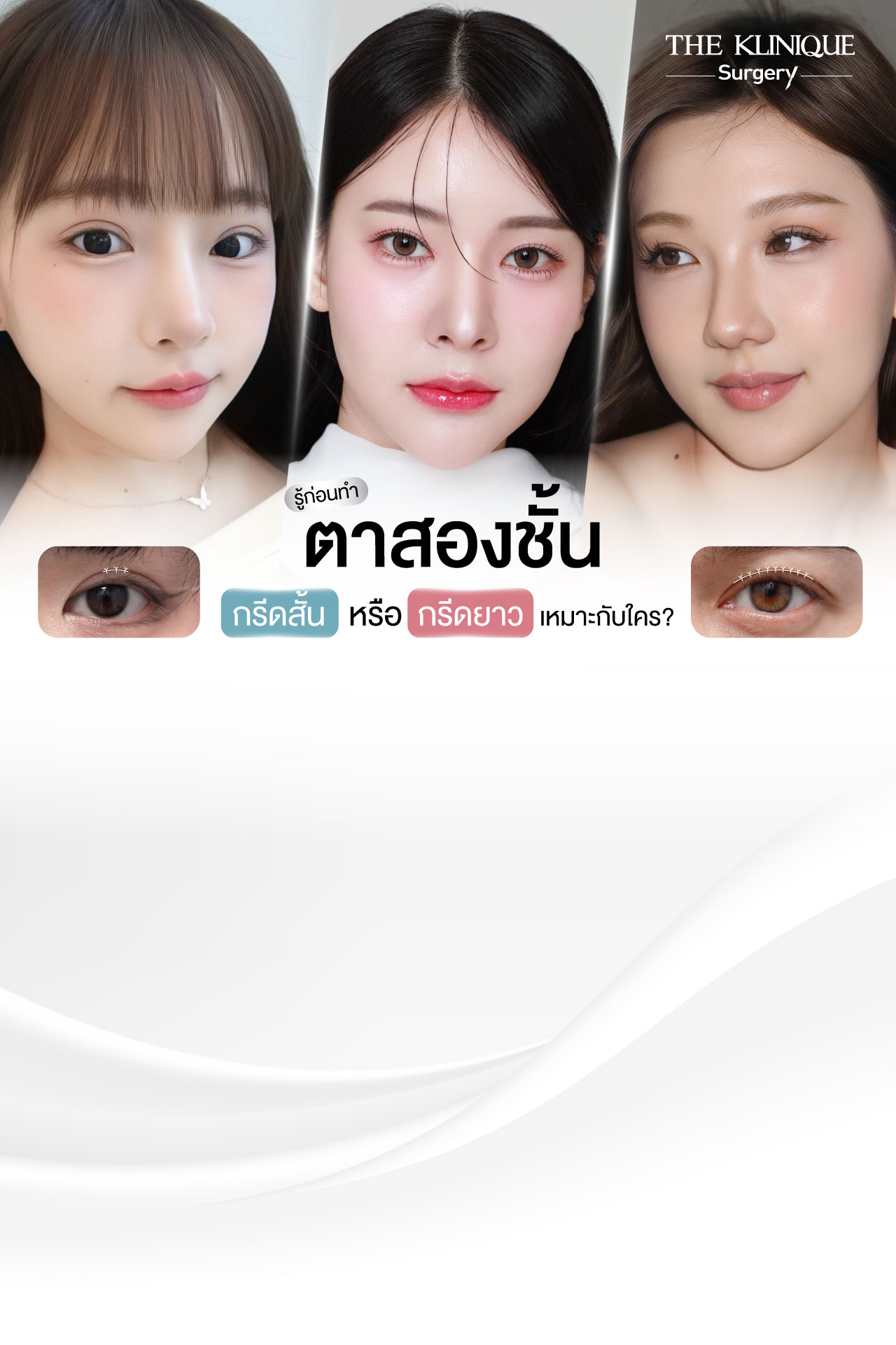 ศัลยกรรมตา, ศัลยกรรมตาสองชั้น, ศัลยกรรมตาสองชั้น ราคา, ศัลยกรรมตาที่ไหนดี, ศัลยกรรมตามีกี่แบบ, ตาสองชั้น, ตาสองชั้นหลบใน, คลินิกทำตา, ตาสองชั้นที่ไหนดี, ตาสองชั้นแบบกรีดสั้น กรีดยาว, กล้ามเนื้อตาอ่อนแรง, แก้ตา, แก้ตาสองชั้น, แก้หนังตาตก, แก้ชั้นตาใหญ่, แก้ตาไม่เท่ากัน, หนังตาตก, แก้หนังตาตก, ตาสองชั้นรีวิว, ตา 2 ชั้น, รีวิว ตาสองชั้น, ทำตาสองชั้น, Sub Brow Lift, Foxy eyes, ยกหางตา, หางตาตก, หมอศัลยกรรมตา