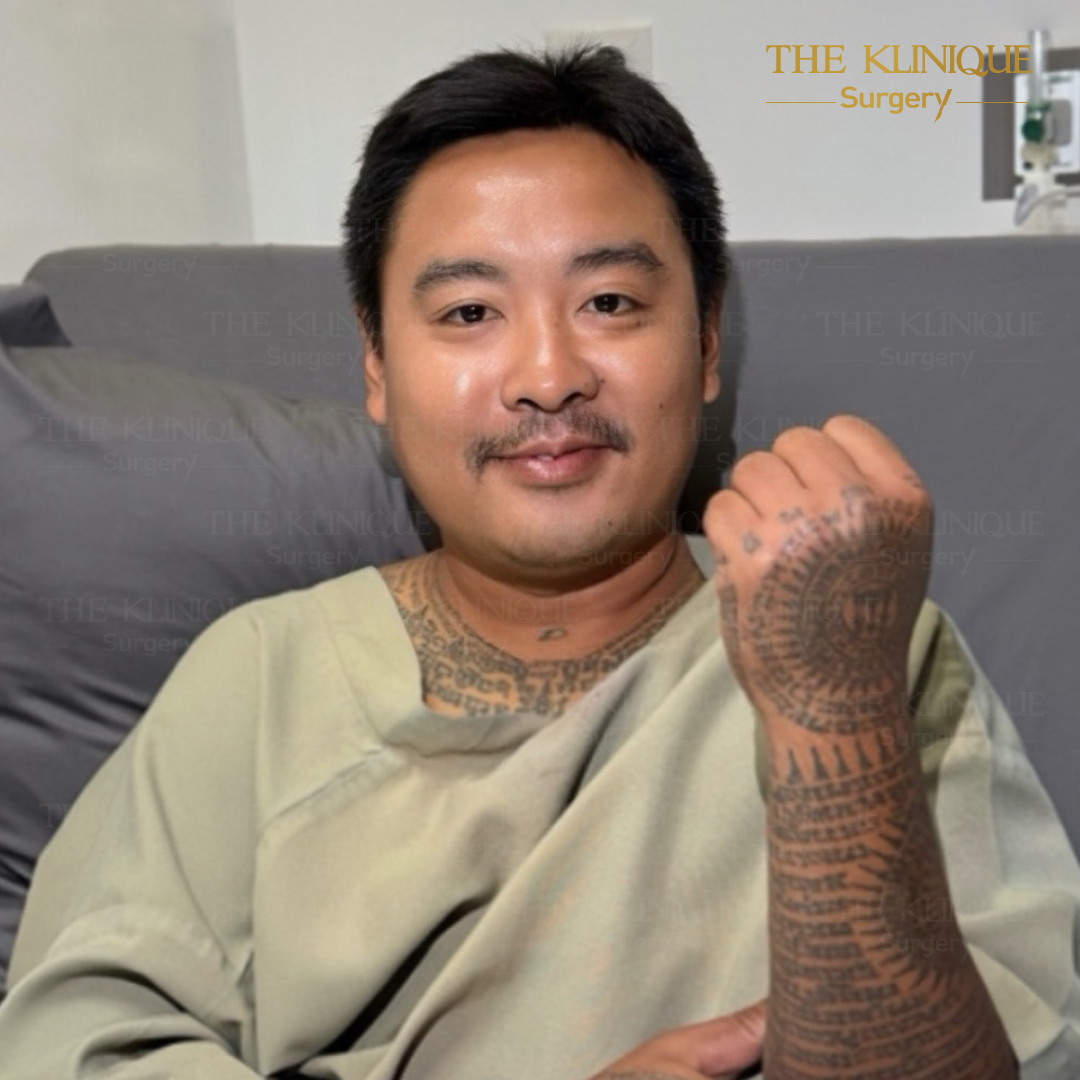 ฟิลเลอร์น้อง, ฟิลเลอร์น้องชาย, ปรับขนาดน้องชาย, ขลิบ, ขลิบไร้เลือด, ขลิบไร้เลือด ราคา, ขลิบไร้เลือดที่ไหนดี, เพิ่มขนาดน้องชาย, เพิ่มขนาดอวัยวะเพศชาย, ฉีดฟิลเลอร์