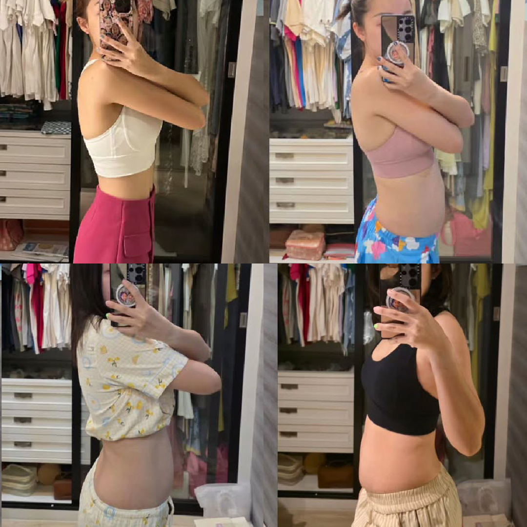 Liposuction, Sculpting,Xshape,Lipo, ศัลยกรรมดูดไขมัน, ดูดไขมัน,คลินิกดูดไขมัน,ดูดไขมันเฉพาะส่วน,ดูดไขมันเหนียง,ดูดไขมันหน้าท้อง,ดูดไขมันรีวิว, รีวิวดูดไขมัน, รีวิวดูดไขมันหน้าท้อง,ดูดไขมันต้นแขน, ดูดไขมันต้นขา,ดูดไขมันน่อง, ลดความอ้วน, ดูดไขมันที่ไหนดี, ดูดไขมันราคา, ดูดไขมันทั้งตัว,รีวิวดูดไขมันต้นขา,เอวเอส, เอวเล็ก, เอวคอด, ปั้นเอว, ปั้นหุ่น,สร้างซิกแพค,ร่อง 11,ปั้นร่อง11, ลดเอวหนา, ปั้นร่อง 11 ผู้หญิง, ลดน้าท้อง, ลดต้นแขนล ลดต้นขา, ดูดไขมัน ลดหุ่น, เอวบาง, Sexyline, Sexyline รีวิว