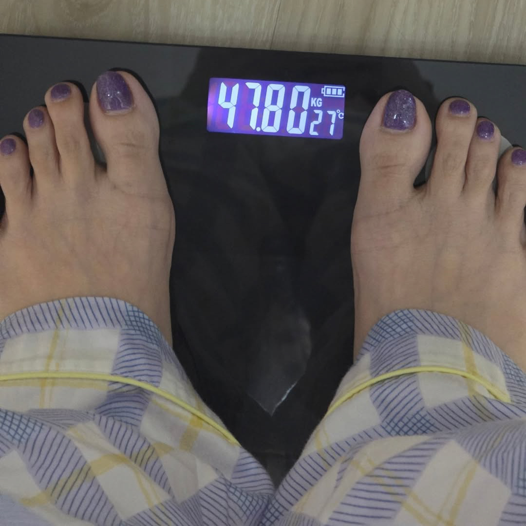 Liposuction, Sculpting,Xshape,Lipo, ศัลยกรรมดูดไขมัน, ดูดไขมัน,คลินิกดูดไขมัน,ดูดไขมันเฉพาะส่วน,ดูดไขมันเหนียง,ดูดไขมันหน้าท้อง,ดูดไขมันรีวิว, รีวิวดูดไขมัน, รีวิวดูดไขมันหน้าท้อง,ดูดไขมันต้นแขน, ดูดไขมันต้นขา,ดูดไขมันน่อง, ลดความอ้วน, ดูดไขมันที่ไหนดี, ดูดไขมันราคา, ดูดไขมันทั้งตัว,รีวิวดูดไขมันต้นขา,เอวเอส, เอวเล็ก, เอวคอด, ปั้นเอว, ปั้นหุ่น,สร้างซิกแพค,ร่อง 11,ปั้นร่อง11, ลดเอวหนา, ปั้นร่อง 11 ผู้หญิง, ลดน้าท้อง, ลดต้นแขนล ลดต้นขา, ดูดไขมัน ลดหุ่น, เอวบาง, Sexyline, Sexyline รีวิว