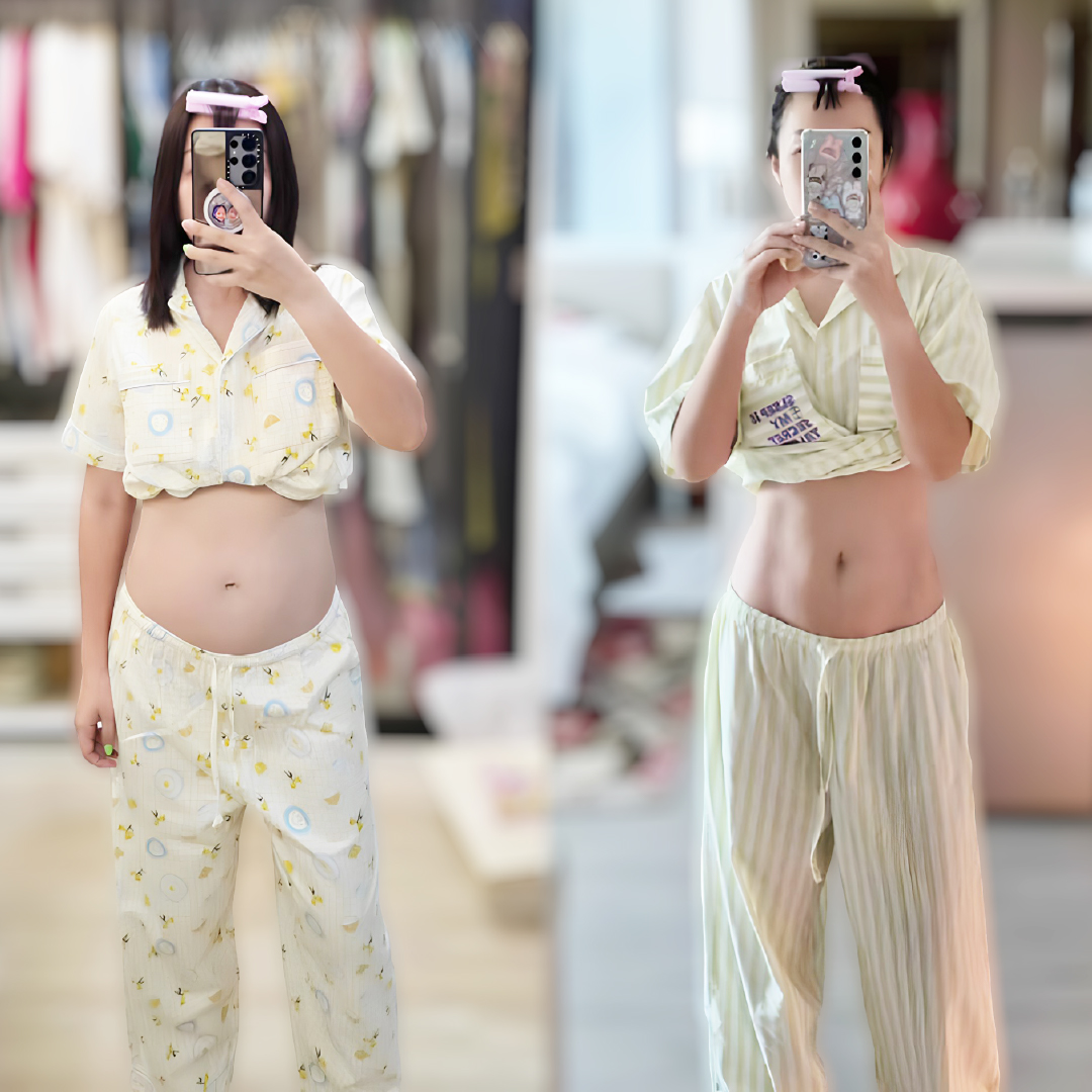 Liposuction, Sculpting,Xshape,Lipo, ศัลยกรรมดูดไขมัน, ดูดไขมัน,คลินิกดูดไขมัน,ดูดไขมันเฉพาะส่วน,ดูดไขมันเหนียง,ดูดไขมันหน้าท้อง,ดูดไขมันรีวิว, รีวิวดูดไขมัน, รีวิวดูดไขมันหน้าท้อง,ดูดไขมันต้นแขน, ดูดไขมันต้นขา,ดูดไขมันน่อง, ลดความอ้วน, ดูดไขมันที่ไหนดี, ดูดไขมันราคา, ดูดไขมันทั้งตัว,รีวิวดูดไขมันต้นขา,เอวเอส, เอวเล็ก, เอวคอด, ปั้นเอว, ปั้นหุ่น,สร้างซิกแพค,ร่อง 11,ปั้นร่อง11, ลดเอวหนา, ปั้นร่อง 11 ผู้หญิง, ลดน้าท้อง, ลดต้นแขนล ลดต้นขา, ดูดไขมัน ลดหุ่น, เอวบาง, Sexyline, Sexyline รีวิว