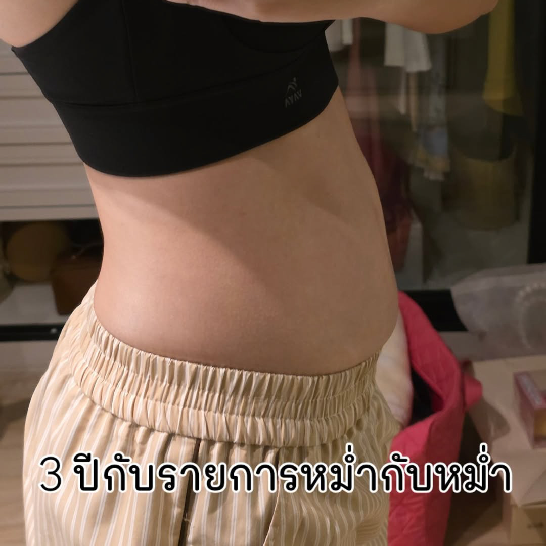 Liposuction, Sculpting,Xshape,Lipo, ศัลยกรรมดูดไขมัน, ดูดไขมัน,คลินิกดูดไขมัน,ดูดไขมันเฉพาะส่วน,ดูดไขมันเหนียง,ดูดไขมันหน้าท้อง,ดูดไขมันรีวิว, รีวิวดูดไขมัน, รีวิวดูดไขมันหน้าท้อง,ดูดไขมันต้นแขน, ดูดไขมันต้นขา,ดูดไขมันน่อง, ลดความอ้วน, ดูดไขมันที่ไหนดี, ดูดไขมันราคา, ดูดไขมันทั้งตัว,รีวิวดูดไขมันต้นขา,เอวเอส, เอวเล็ก, เอวคอด, ปั้นเอว, ปั้นหุ่น,สร้างซิกแพค,ร่อง 11,ปั้นร่อง11, ลดเอวหนา, ปั้นร่อง 11 ผู้หญิง, ลดน้าท้อง, ลดต้นแขนล ลดต้นขา, ดูดไขมัน ลดหุ่น, เอวบาง, Sexyline, Sexyline รีวิว