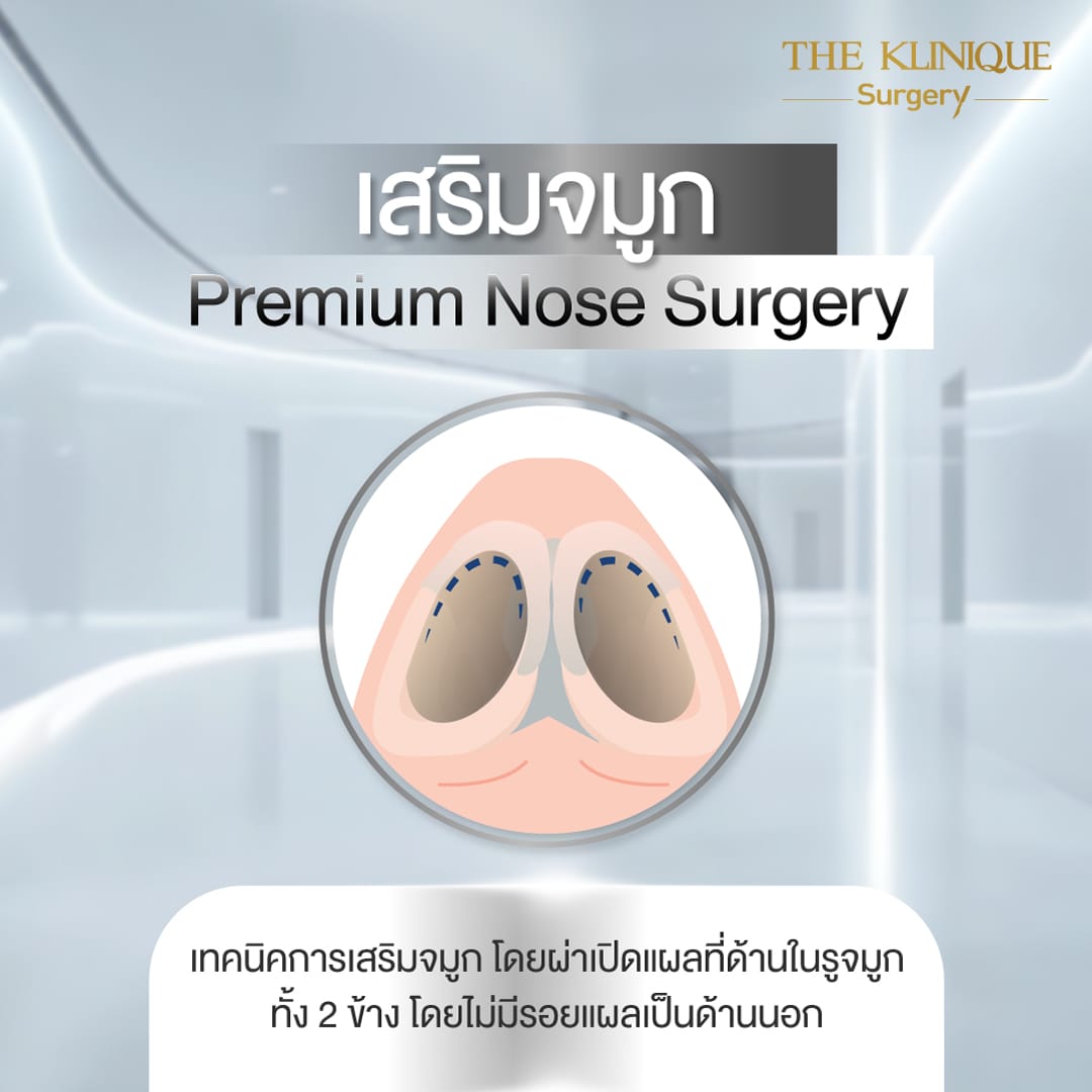 Review-SemiOpen-Rhinoplasty-KoreanStyle