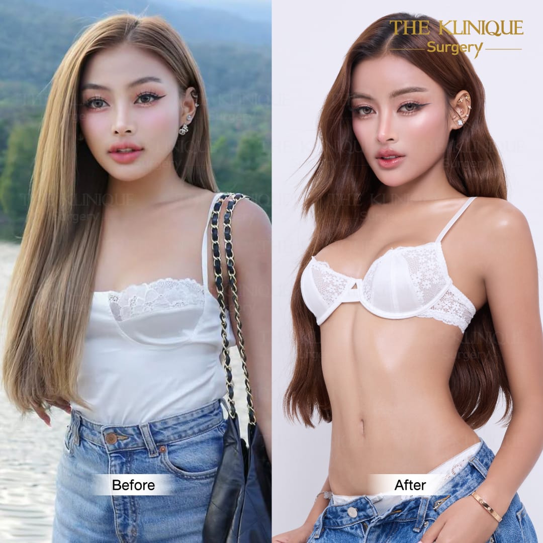 Nesty-review-Breast-Reconstruction