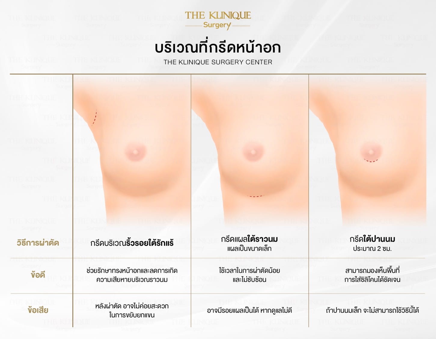 review-breast-lift-reconstruction