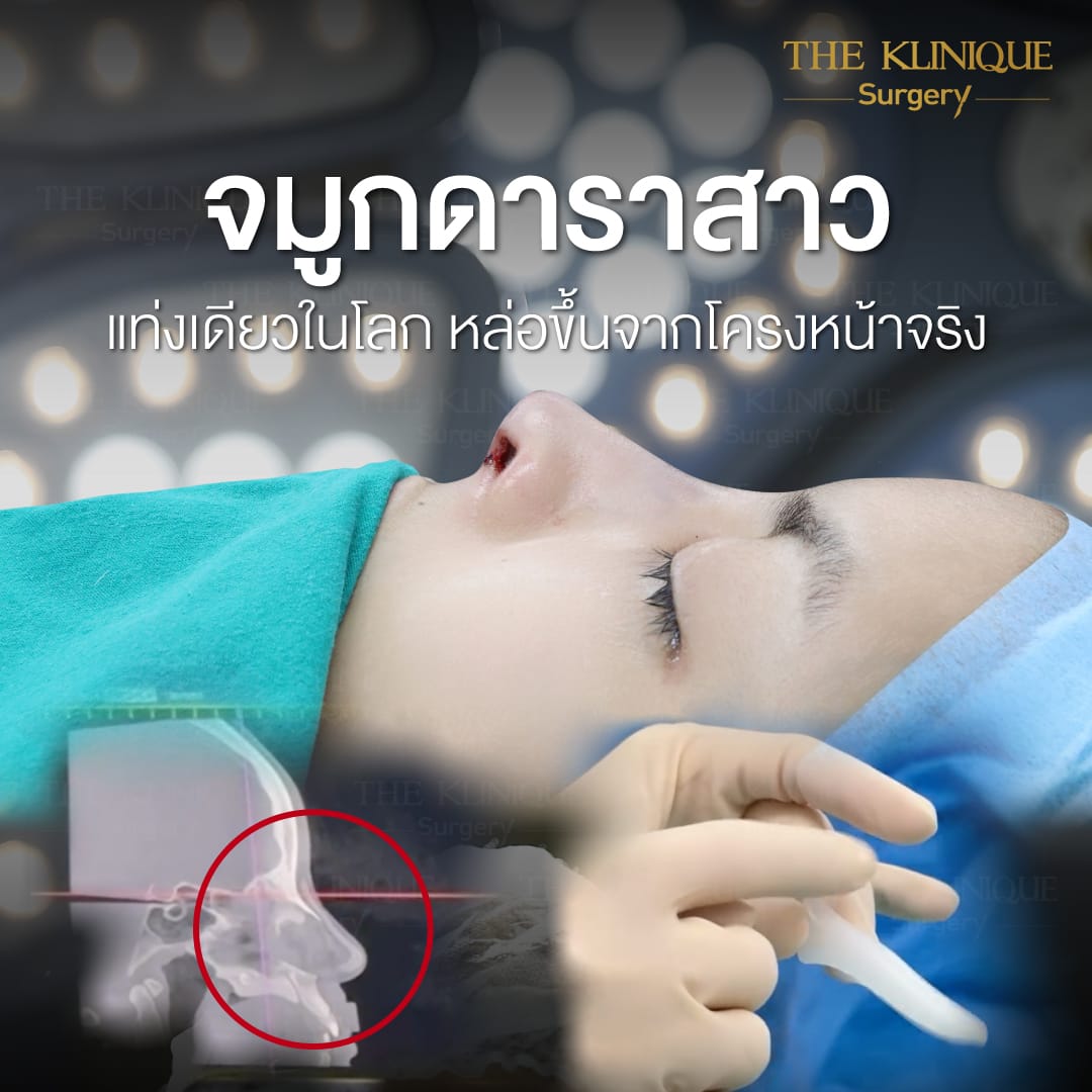 Review-Reconstructive-NoseSurgery-Nampetch