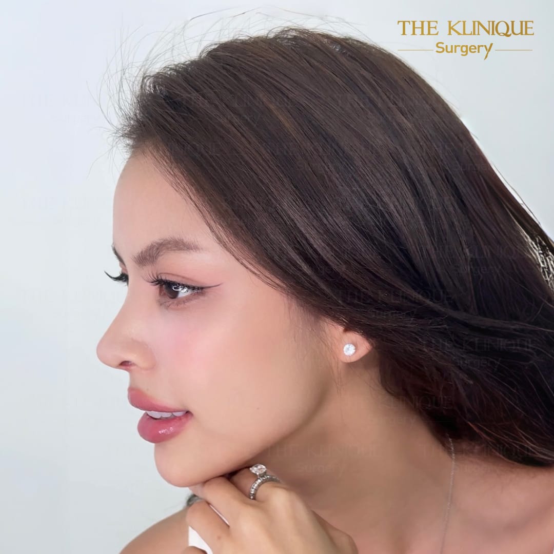 Review-Reconstructive-NoseSurgery-Nampetch