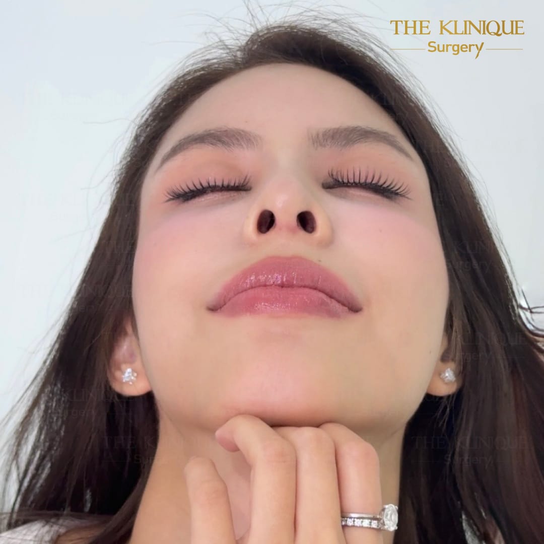 Review-Reconstructive-NoseSurgery-Nampetch