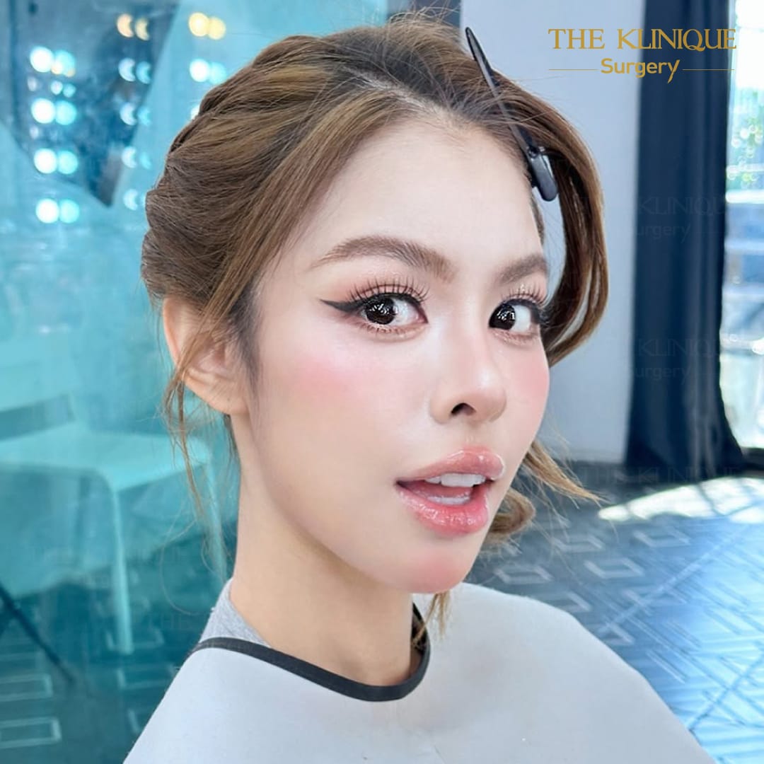 Review-Reconstructive-NoseSurgery-Nampetch