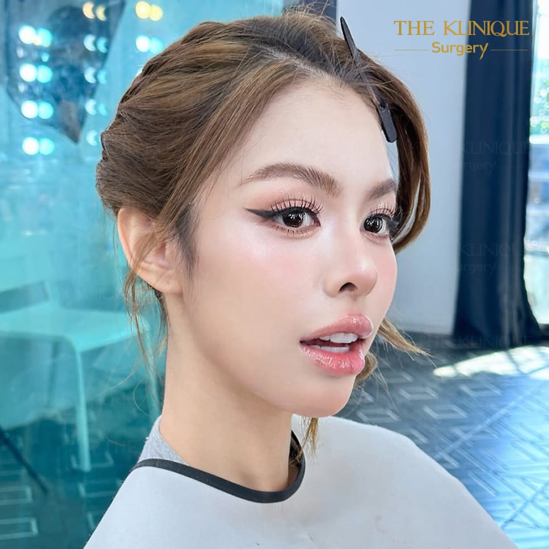 Review-Reconstructive-NoseSurgery-Nampetch