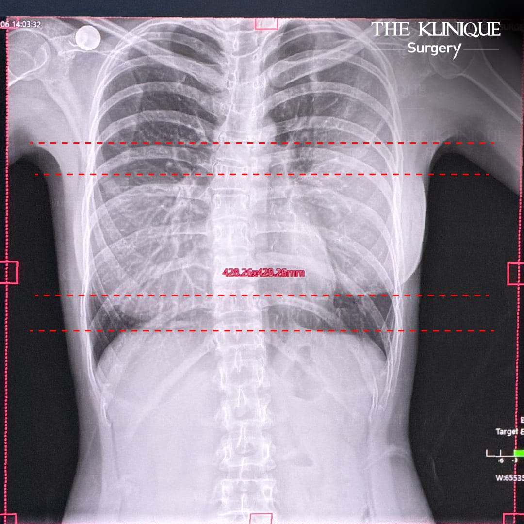 review-Breast-Reconstruction-Yokthong