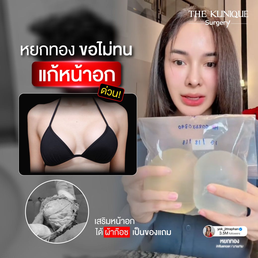 review-Breast-Reconstruction-Yokthong