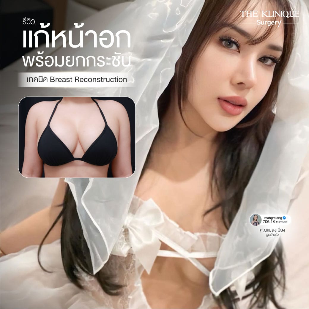 review-breast-lift-reconstruction