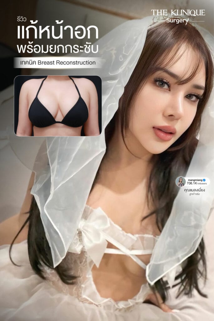 review-breast-lift-reconstruction