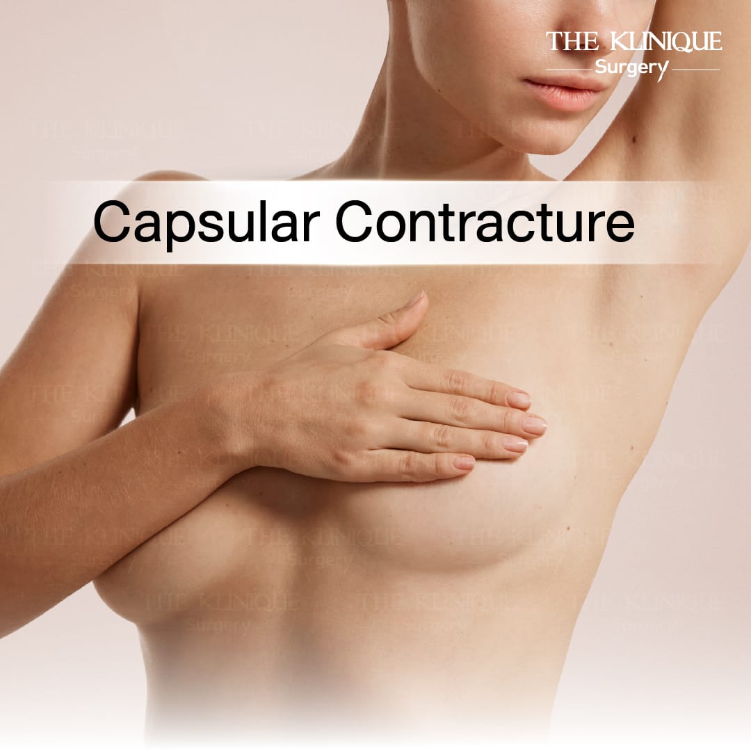 yokthong-breast-reconstruction-natural-results