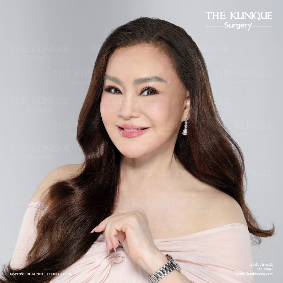 ดึงหน้าดารา, ดึงหน้า, ศัลยกรรมดึงหน้า,ดึงหน้าย้อนวัย, ดึงหน้าที่ไหนดี, ผ่าตัดดึงหน้า, ยกคิ้ว, ยกหางตา, หางตาตก, ดึงหน้าดารา, ดึงหน้ารีวิว, Facelift, Neck lift, Endotine, ยกคิ้ว Endotine,Foxy Eyes, แก้หนังตาตก , แก้ตาไม่เท่ากัน ,หนังตาตก,แก้หนังตาตก,ยกคิ้ว รีวิว, ยกคิ้วส่องกล้อง, ยกคิ้วที่ไหนดี, ยกคิ้ว,ศัลยกรรมยกคิ้ว,ดึงหน้าส่องกล้อง,ดึงหน้า Facelock, Hollywood facelock,ดึงหน้าFacelift, รีวิวFacelift, ดึงหน้าย้อนวัย, ดึงหน้าลดอายุ