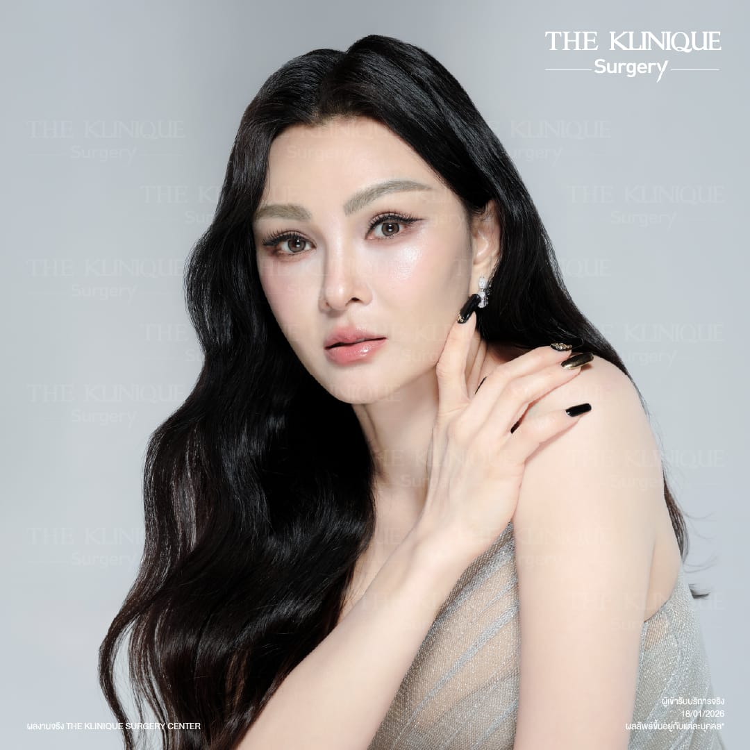 ดึงหน้าดารา, ดึงหน้า, ศัลยกรรมดึงหน้า,ดึงหน้าย้อนวัย, ดึงหน้าที่ไหนดี, ผ่าตัดดึงหน้า, ยกคิ้ว, ยกหางตา, หางตาตก, ดึงหน้าดารา, ดึงหน้ารีวิว, Facelift, Neck lift, Endotine, ยกคิ้ว Endotine,Foxy Eyes, แก้หนังตาตก , แก้ตาไม่เท่ากัน ,หนังตาตก,แก้หนังตาตก,ยกคิ้ว รีวิว, ยกคิ้วส่องกล้อง, ยกคิ้วที่ไหนดี, ยกคิ้ว,ศัลยกรรมยกคิ้ว,ดึงหน้าส่องกล้อง,ดึงหน้า Facelock, Hollywood facelock,ดึงหน้าFacelift, รีวิวFacelift, ดึงหน้าย้อนวัย, ดึงหน้าลดอายุ