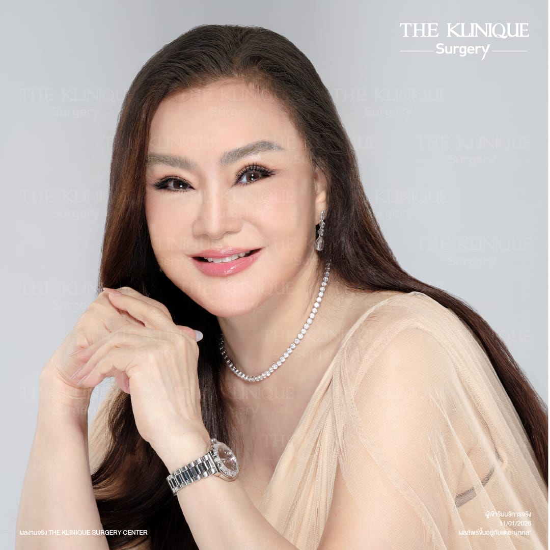 ดึงหน้าดารา, ดึงหน้า, ศัลยกรรมดึงหน้า,ดึงหน้าย้อนวัย, ดึงหน้าที่ไหนดี, ผ่าตัดดึงหน้า, ยกคิ้ว, ยกหางตา, หางตาตก, ดึงหน้าดารา, ดึงหน้ารีวิว, Facelift, Neck lift, Endotine, ยกคิ้ว Endotine,Foxy Eyes, แก้หนังตาตก , แก้ตาไม่เท่ากัน ,หนังตาตก,แก้หนังตาตก,ยกคิ้ว รีวิว, ยกคิ้วส่องกล้อง, ยกคิ้วที่ไหนดี, ยกคิ้ว,ศัลยกรรมยกคิ้ว,ดึงหน้าส่องกล้อง,ดึงหน้า Facelock, Hollywood facelock,ดึงหน้าFacelift, รีวิวFacelift, ดึงหน้าย้อนวัย, ดึงหน้าลดอายุ