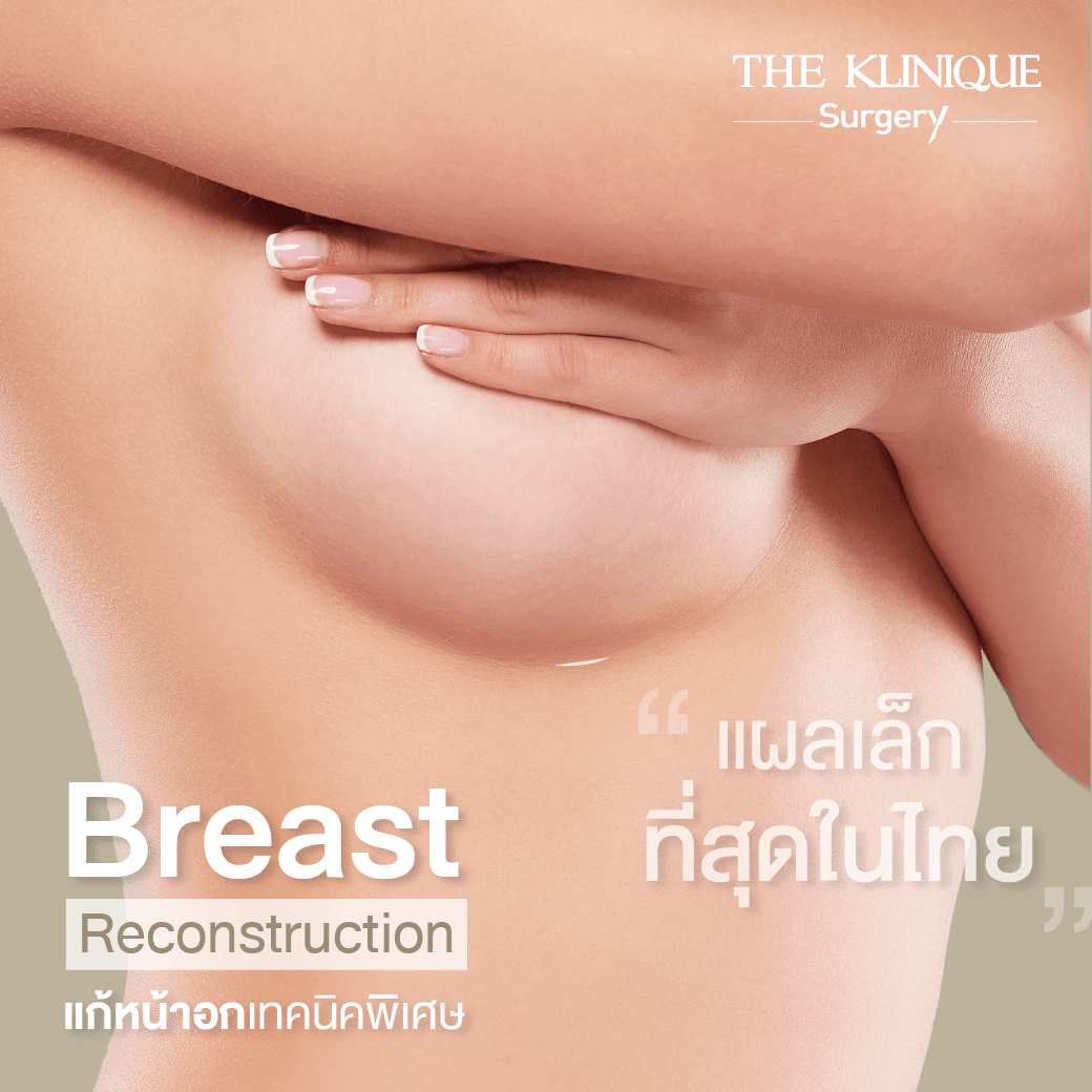 review-breast-lift-reconstruction