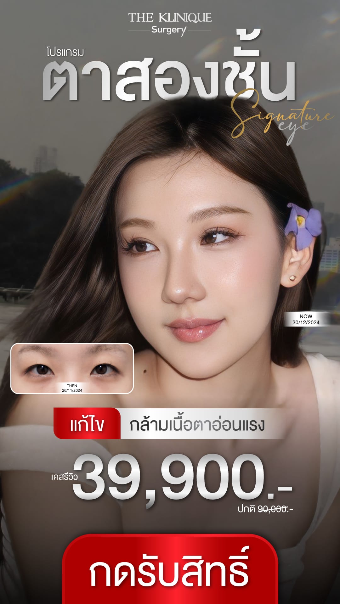 ตาสองชั้น” style=