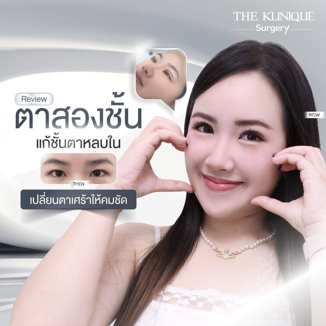 รีวิวทำตาสองชั้น แก้ไขปัญหาตาหลบใน