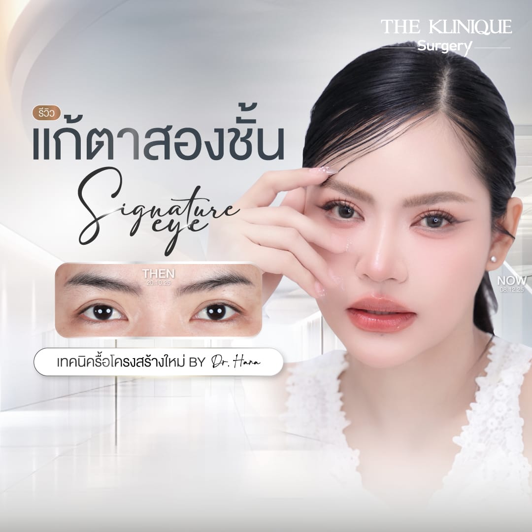 ศัลยกรรมตา, ศัลยกรรมตาสองชั้น, ศัลยกรรมตาสองชั้น ราคา, ศัลยกรรมตาที่ไหนดี, ศัลยกรรมตามีกี่แบบ, ตาสองชั้น, ตาสองชั้นหลบใน, คลินิกทำตา, ตาสองชั้นที่ไหนดี, ตาสองชั้นแบบกรีดสั้น กรีดยาว, กล้ามเนื้อตาอ่อนแรง, แก้ตา, แก้ตาสองชั้น, แก้หนังตาตก, แก้ชั้นตาใหญ่, แก้ตาไม่เท่ากัน, หนังตาตก, แก้หนังตาตก,Ophthalmologis,จักษุศัลยแพทย์,คลินิกทำตาสองชั้น ใจกลางสยามสแคว์ , แก้ตาอ่อนแรง ใจกลางสยาม,ตาง่วง, ตาปรือ, ทำตาสองชั้นที่ไหนดี, แพทย์ Oculoplastic, มัดกล้ามเนื้อตา, รีวิวแก้กล้ามเนื้อตาอ่อนแรง, แก้ไขกล้ามเนื้อตาอ่อนแรง