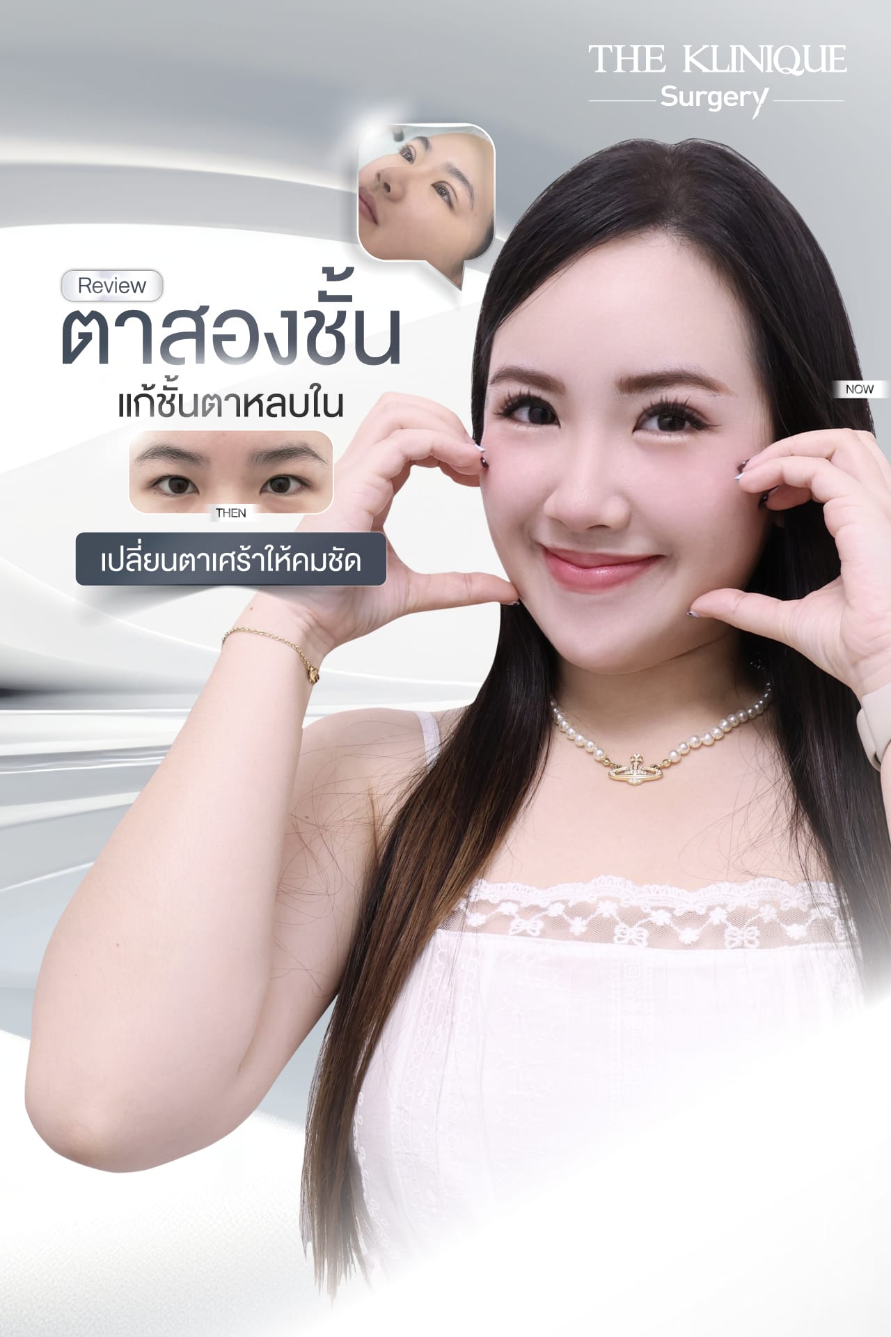 รีวิวทำตาสองชั้น แก้ไขปัญหาตาหลบใน