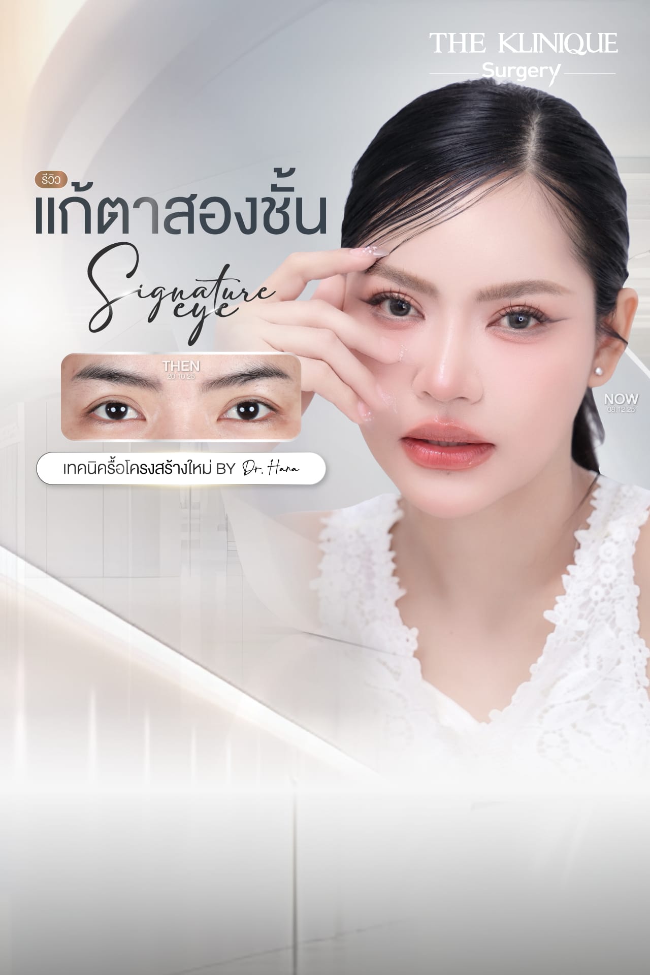 ศัลยกรรมตา, ศัลยกรรมตาสองชั้น, ศัลยกรรมตาสองชั้น ราคา, ศัลยกรรมตาที่ไหนดี, ศัลยกรรมตามีกี่แบบ, ตาสองชั้น, ตาสองชั้นหลบใน, คลินิกทำตา, ตาสองชั้นที่ไหนดี, ตาสองชั้นแบบกรีดสั้น กรีดยาว, กล้ามเนื้อตาอ่อนแรง, แก้ตา, แก้ตาสองชั้น, แก้หนังตาตก, แก้ชั้นตาใหญ่, แก้ตาไม่เท่ากัน, หนังตาตก, แก้หนังตาตก,Ophthalmologis,จักษุศัลยแพทย์,คลินิกทำตาสองชั้น ใจกลางสยามสแคว์ , แก้ตาอ่อนแรง ใจกลางสยาม,ตาง่วง, ตาปรือ, ทำตาสองชั้นที่ไหนดี, แพทย์ Oculoplastic, มัดกล้ามเนื้อตา, รีวิวแก้กล้ามเนื้อตาอ่อนแรง, แก้ไขกล้ามเนื้อตาอ่อนแรง