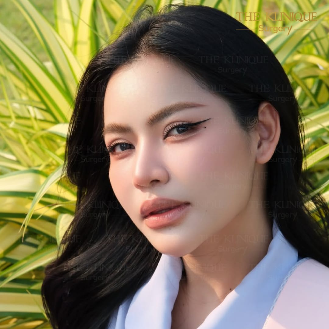 ศัลยกรรมตา, ศัลยกรรมตาสองชั้น, ศัลยกรรมตาสองชั้น ราคา, ศัลยกรรมตาที่ไหนดี, ศัลยกรรมตามีกี่แบบ, ตาสองชั้น, ตาสองชั้นหลบใน, คลินิกทำตา, ตาสองชั้นที่ไหนดี, ตาสองชั้นแบบกรีดสั้น กรีดยาว, กล้ามเนื้อตาอ่อนแรง, แก้ตา, แก้ตาสองชั้น, แก้หนังตาตก, แก้ชั้นตาใหญ่, แก้ตาไม่เท่ากัน, หนังตาตก, แก้หนังตาตก,Ophthalmologis,จักษุศัลยแพทย์,คลินิกทำตาสองชั้น ใจกลางสยามสแคว์ , แก้ตาอ่อนแรง ใจกลางสยาม,ตาง่วง, ตาปรือ, ทำตาสองชั้นที่ไหนดี, แพทย์ Oculoplastic, มัดกล้ามเนื้อตา, รีวิวแก้กล้ามเนื้อตาอ่อนแรง, แก้ไขกล้ามเนื้อตาอ่อนแรง