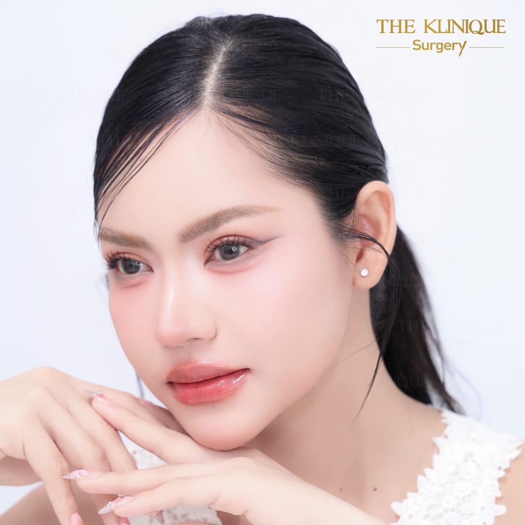 ศัลยกรรมตา, ศัลยกรรมตาสองชั้น, ศัลยกรรมตาสองชั้น ราคา, ศัลยกรรมตาที่ไหนดี, ศัลยกรรมตามีกี่แบบ, ตาสองชั้น, ตาสองชั้นหลบใน, คลินิกทำตา, ตาสองชั้นที่ไหนดี, ตาสองชั้นแบบกรีดสั้น กรีดยาว, กล้ามเนื้อตาอ่อนแรง, แก้ตา, แก้ตาสองชั้น, แก้หนังตาตก, แก้ชั้นตาใหญ่, แก้ตาไม่เท่ากัน, หนังตาตก, แก้หนังตาตก,Ophthalmologis,จักษุศัลยแพทย์,คลินิกทำตาสองชั้น ใจกลางสยามสแคว์ , แก้ตาอ่อนแรง ใจกลางสยาม,ตาง่วง, ตาปรือ, ทำตาสองชั้นที่ไหนดี, แพทย์ Oculoplastic, มัดกล้ามเนื้อตา, รีวิวแก้กล้ามเนื้อตาอ่อนแรง, แก้ไขกล้ามเนื้อตาอ่อนแรง