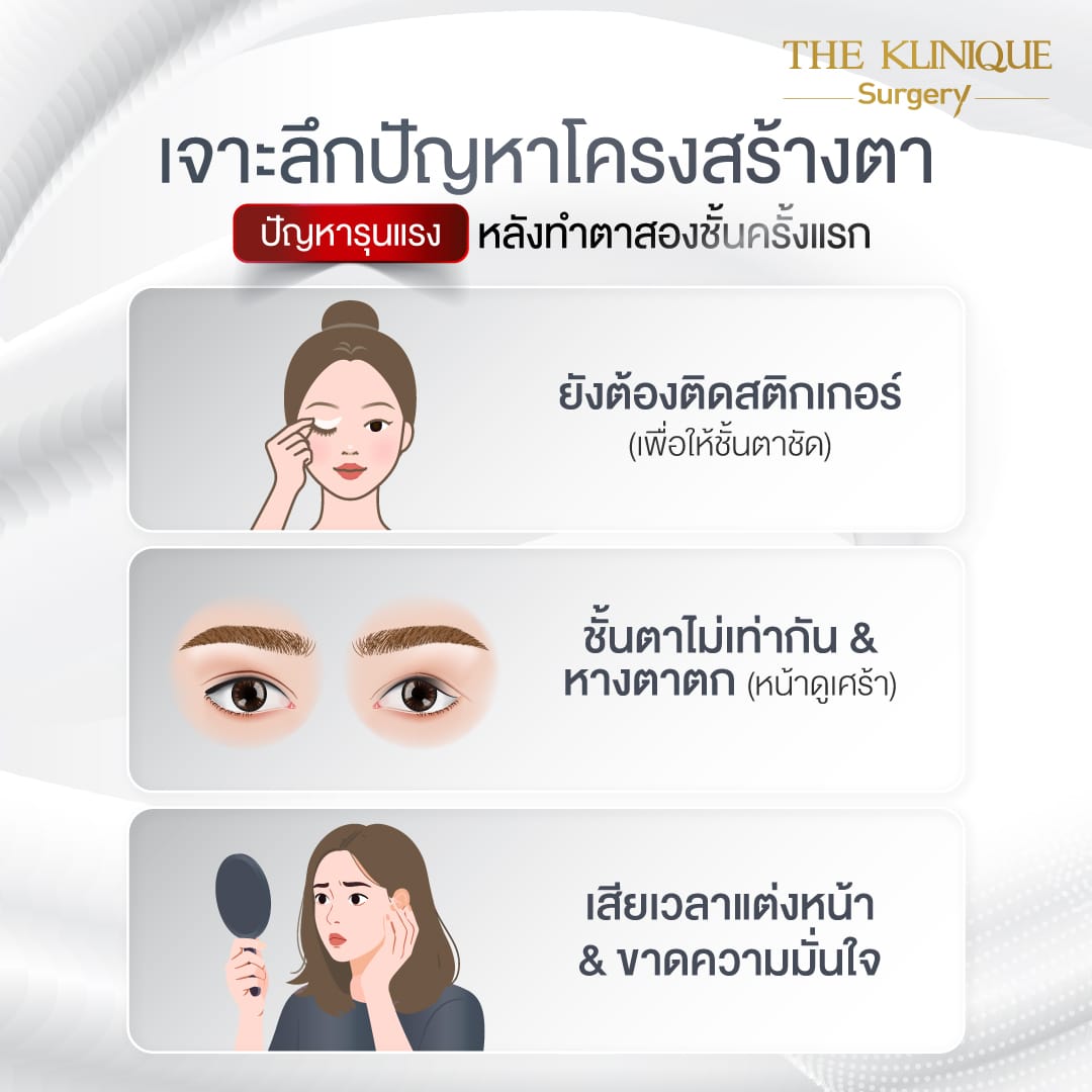 ศัลยกรรมตา, ศัลยกรรมตาสองชั้น, ศัลยกรรมตาสองชั้น ราคา, ศัลยกรรมตาที่ไหนดี, ศัลยกรรมตามีกี่แบบ, ตาสองชั้น, ตาสองชั้นหลบใน, คลินิกทำตา, ตาสองชั้นที่ไหนดี, ตาสองชั้นแบบกรีดสั้น กรีดยาว, กล้ามเนื้อตาอ่อนแรง, แก้ตา, แก้ตาสองชั้น, แก้หนังตาตก, แก้ชั้นตาใหญ่, แก้ตาไม่เท่ากัน, หนังตาตก, แก้หนังตาตก,Ophthalmologis,จักษุศัลยแพทย์,คลินิกทำตาสองชั้น ใจกลางสยามสแคว์ , แก้ตาอ่อนแรง ใจกลางสยาม,ตาง่วง, ตาปรือ, ทำตาสองชั้นที่ไหนดี, แพทย์ Oculoplastic, มัดกล้ามเนื้อตา, รีวิวแก้กล้ามเนื้อตาอ่อนแรง, แก้ไขกล้ามเนื้อตาอ่อนแรง