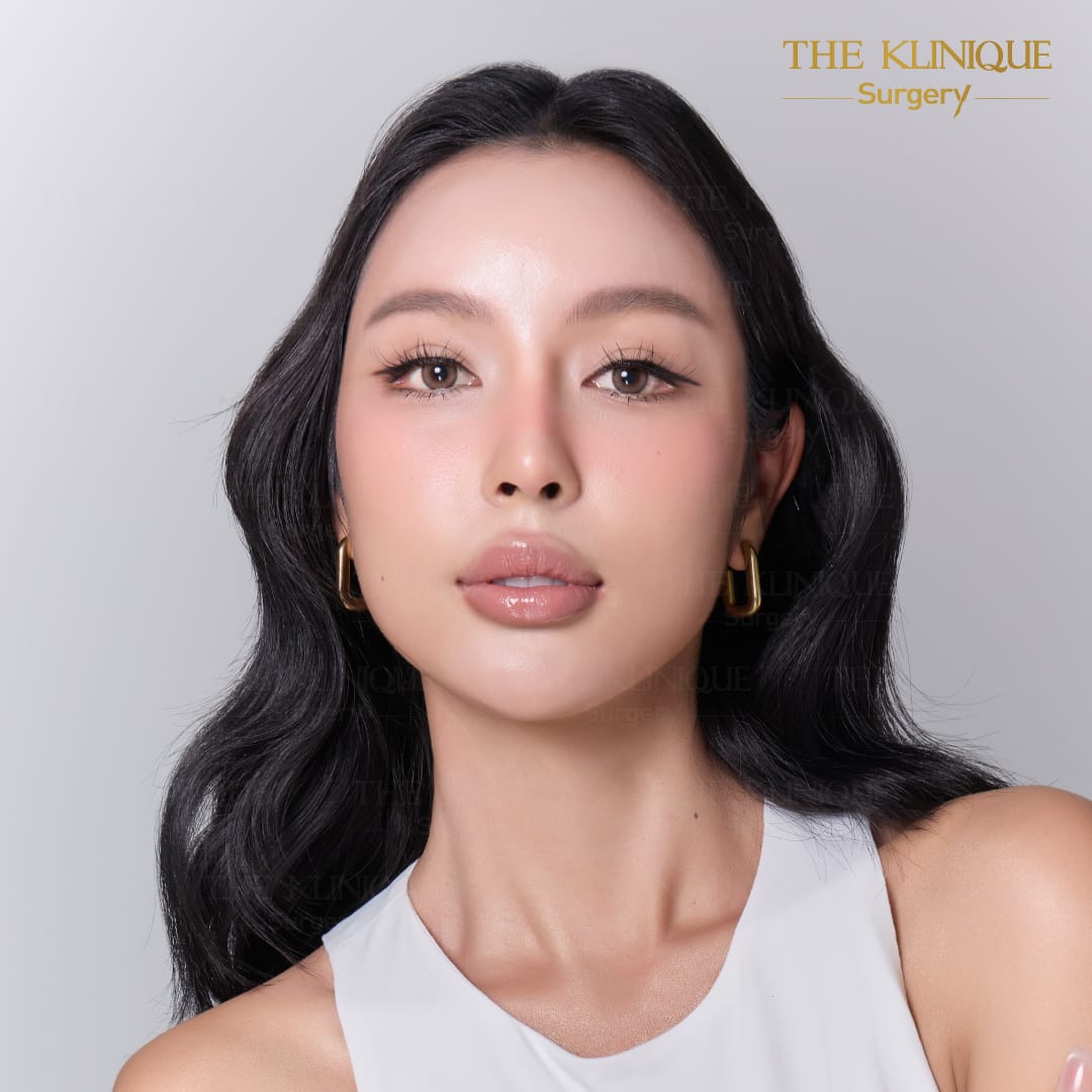 facelift review 10-year younger look before and after skin tightening procedure